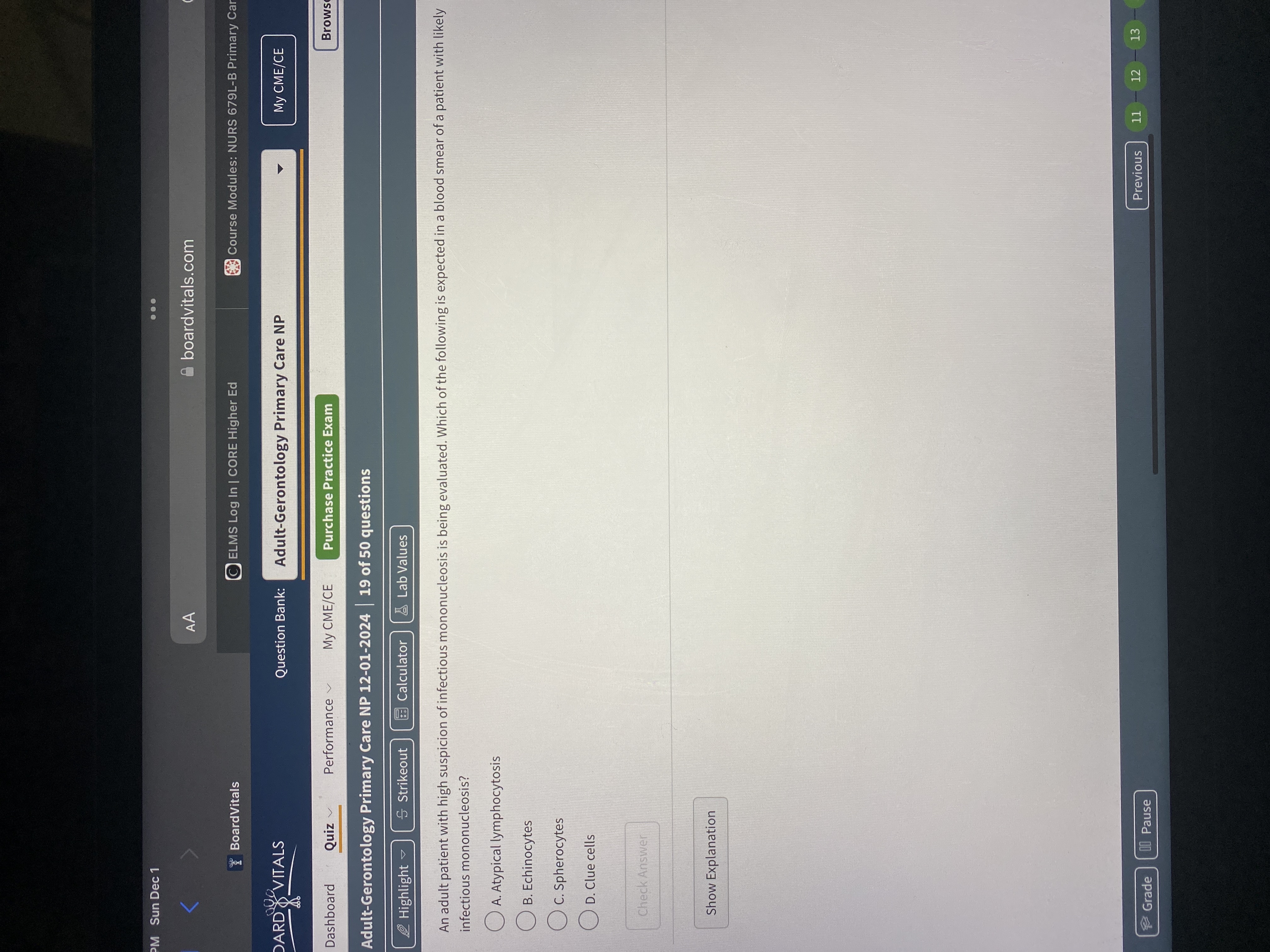 Answer PM Sun Dec 1 AA boardvitals.com