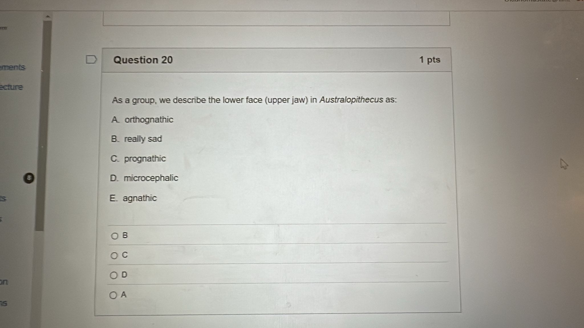 answer D Question 20 1 pts ments ecture As a