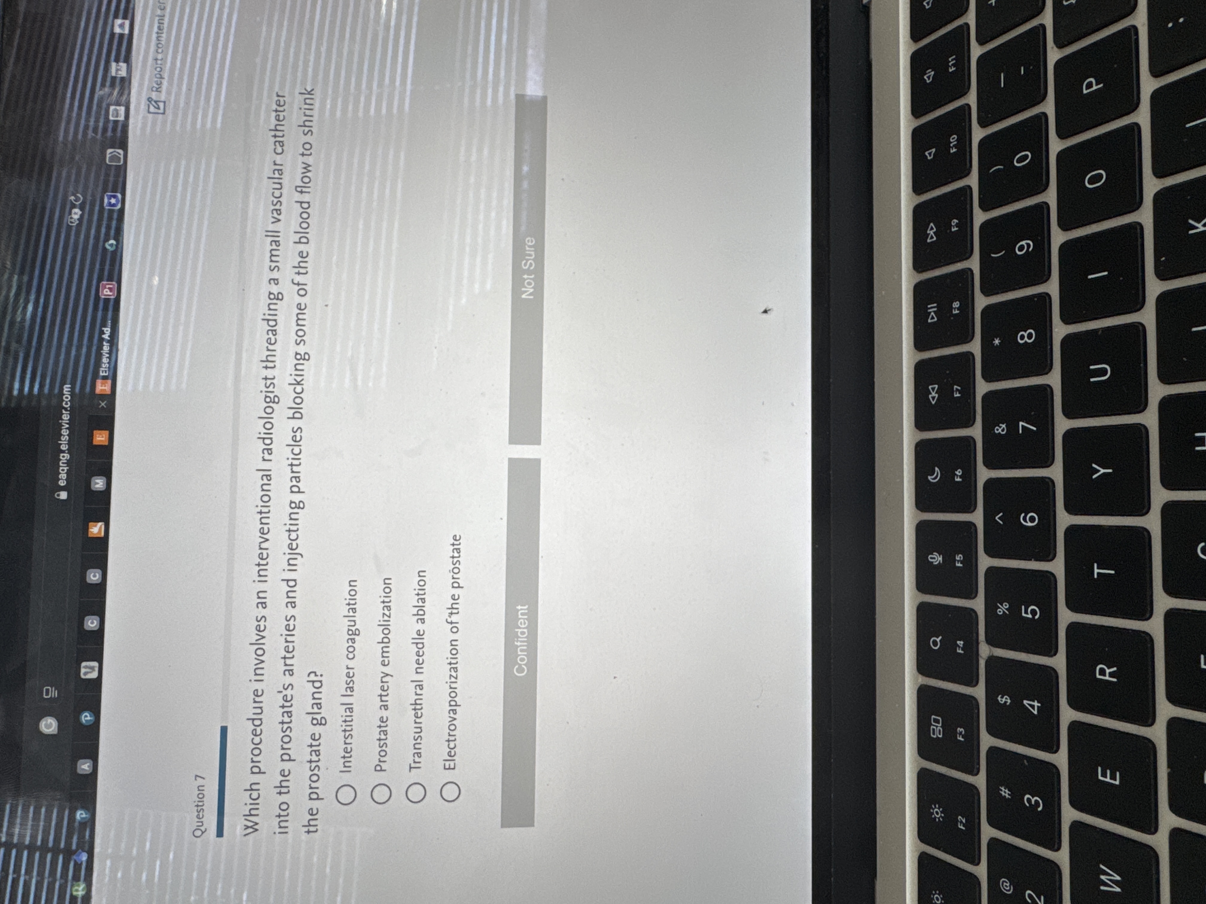 Answer G eagng.elsevier.com A P C C M E E