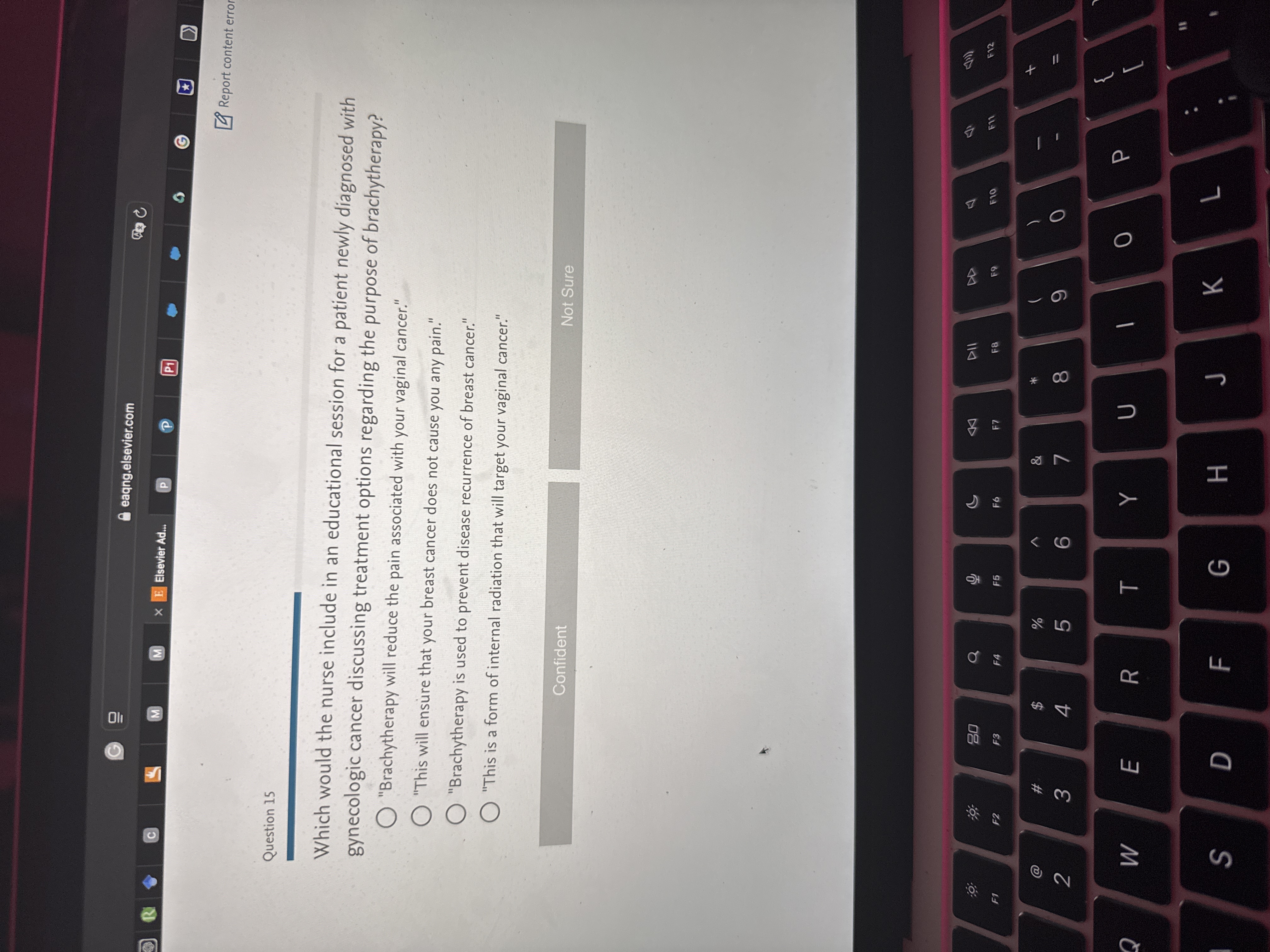 Answer G eaqng.elsevier.com R C M M X E Elsevier