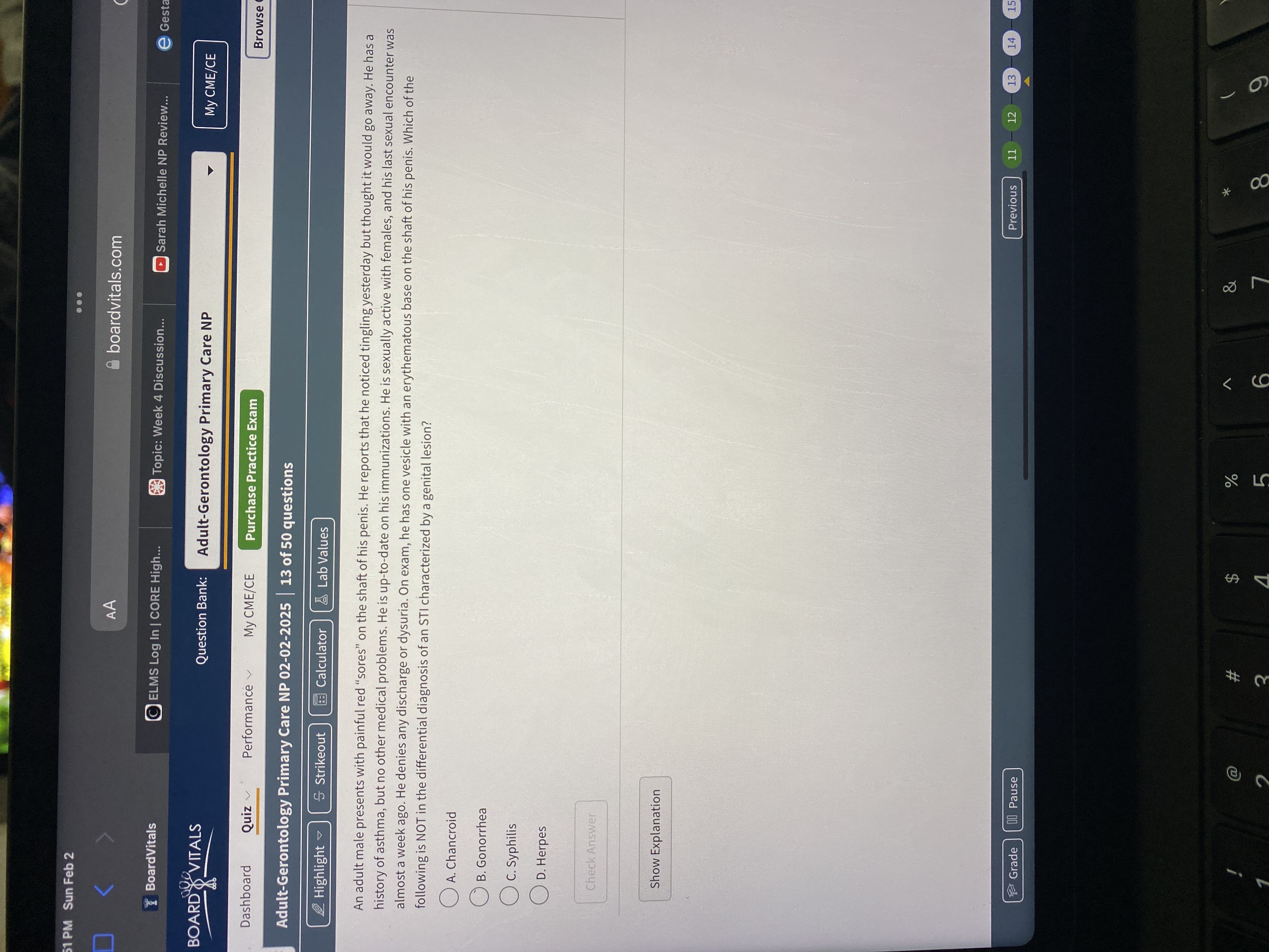 Answer 51 PM Sun Feb 2 .. . AA boardvitals.com