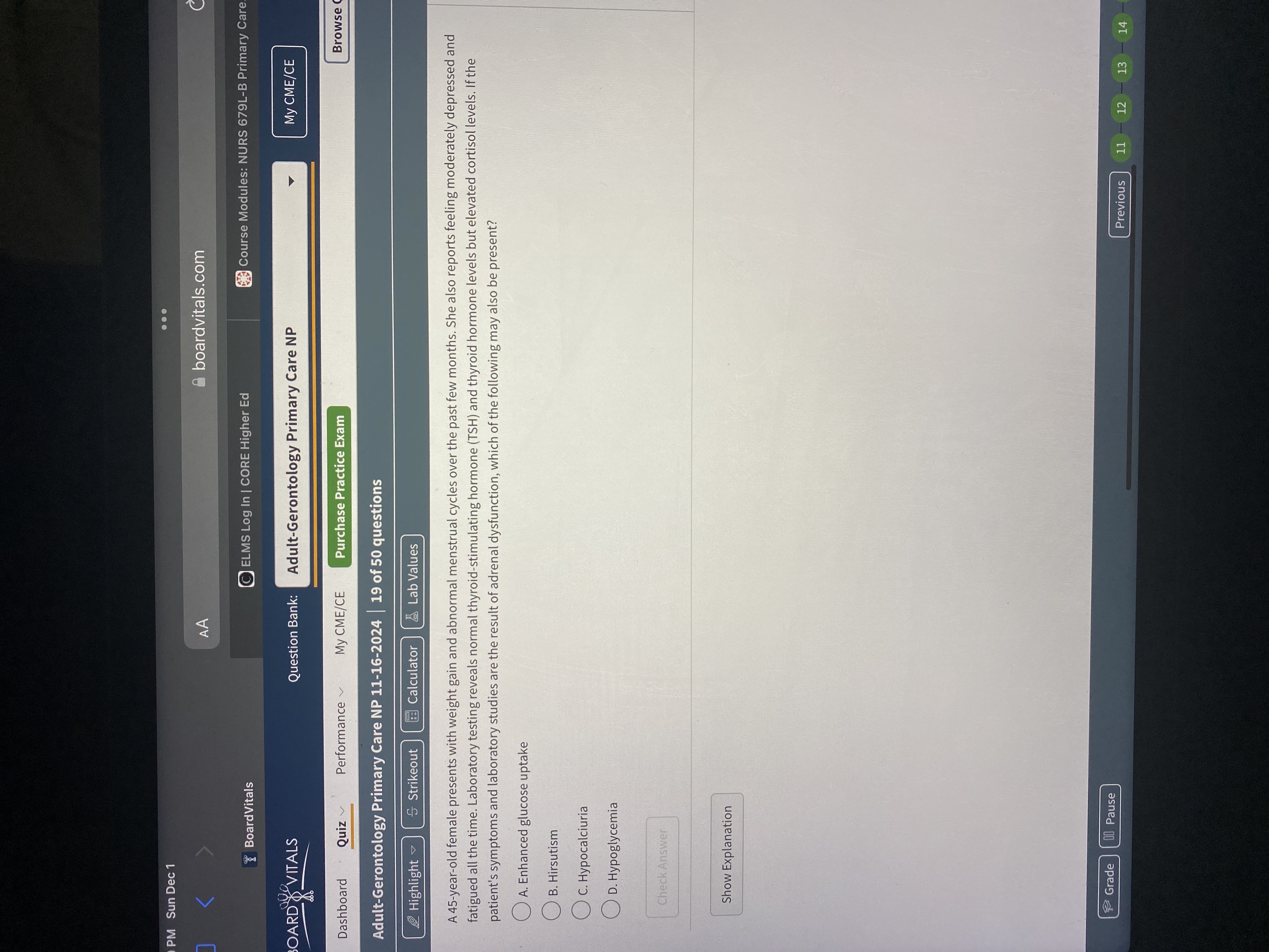 Answer PM Sun Dec 1 . . . AA boardvitals.com