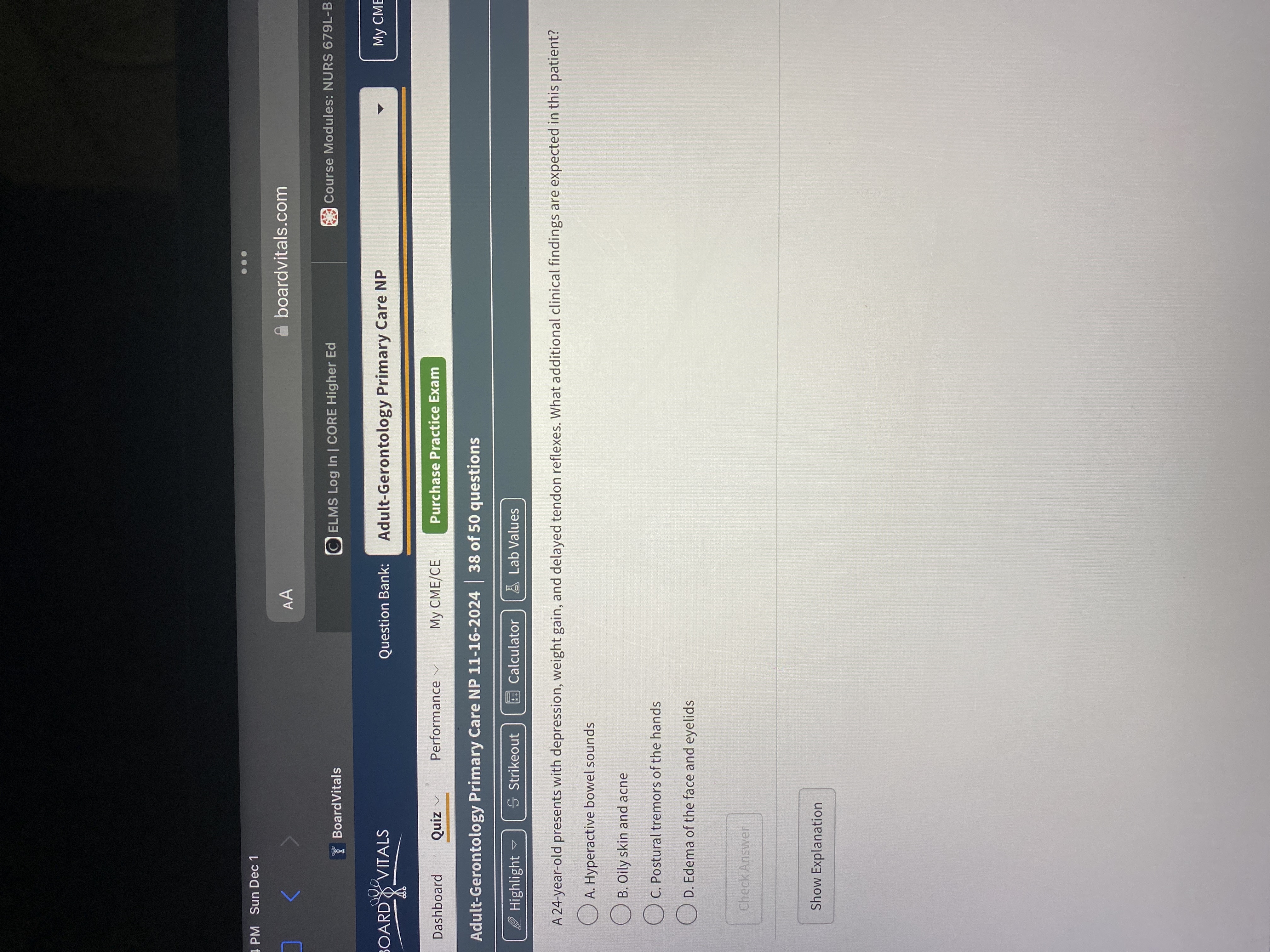 Answer . . . PM Sun Dec 1 AA boardvitals.com