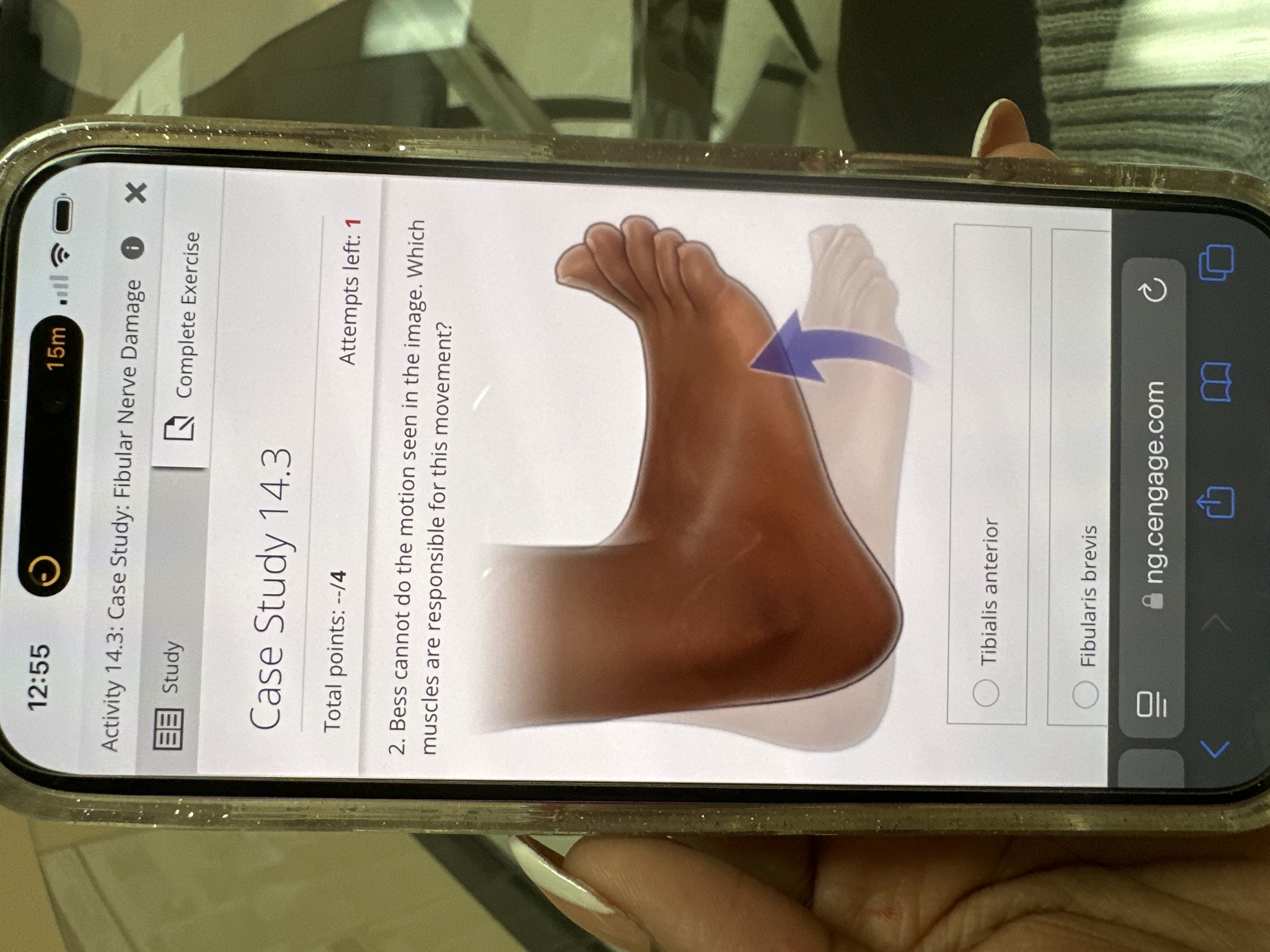 Answer 12:55 15m Activity 14.3: Case Study: