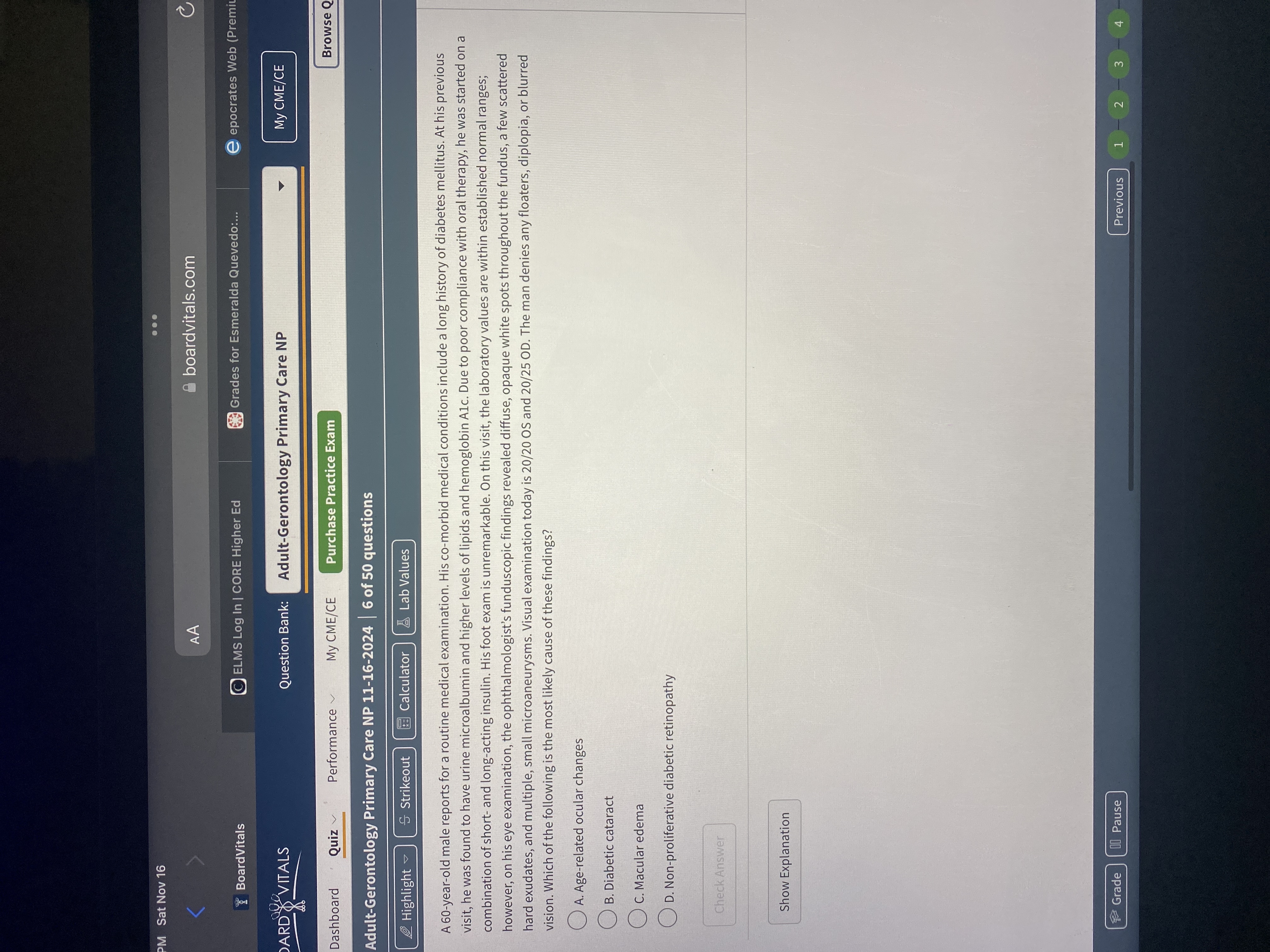 Answer PM Sat Nov 16 . .. AA boardvitals.com