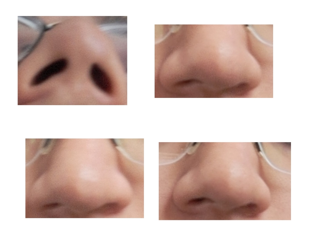 Main question: please provide what exercises and