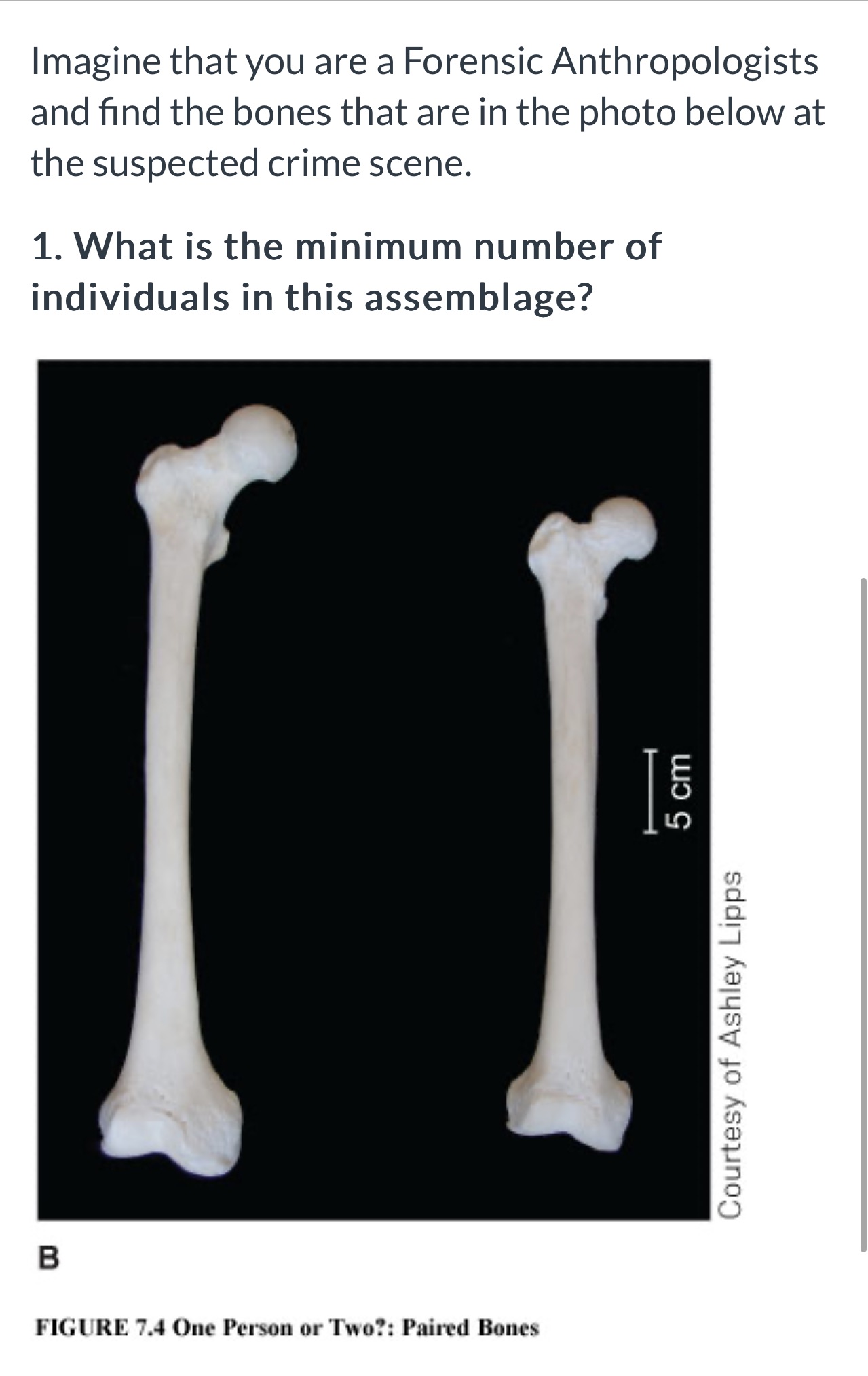 Imagine that you are a Forensic Anthropologists