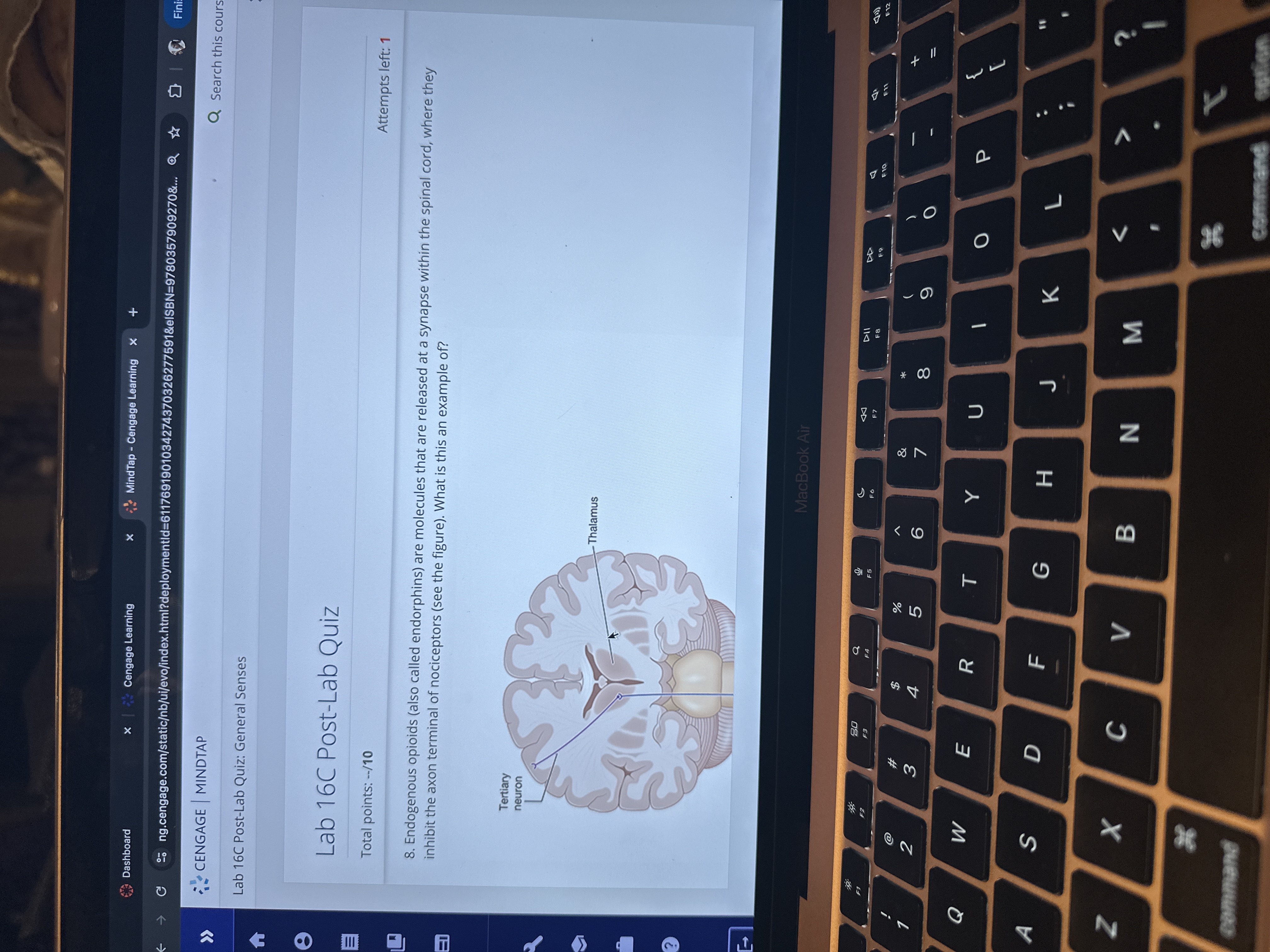 Answer Dashboard x Cengage Learning X MindTap -