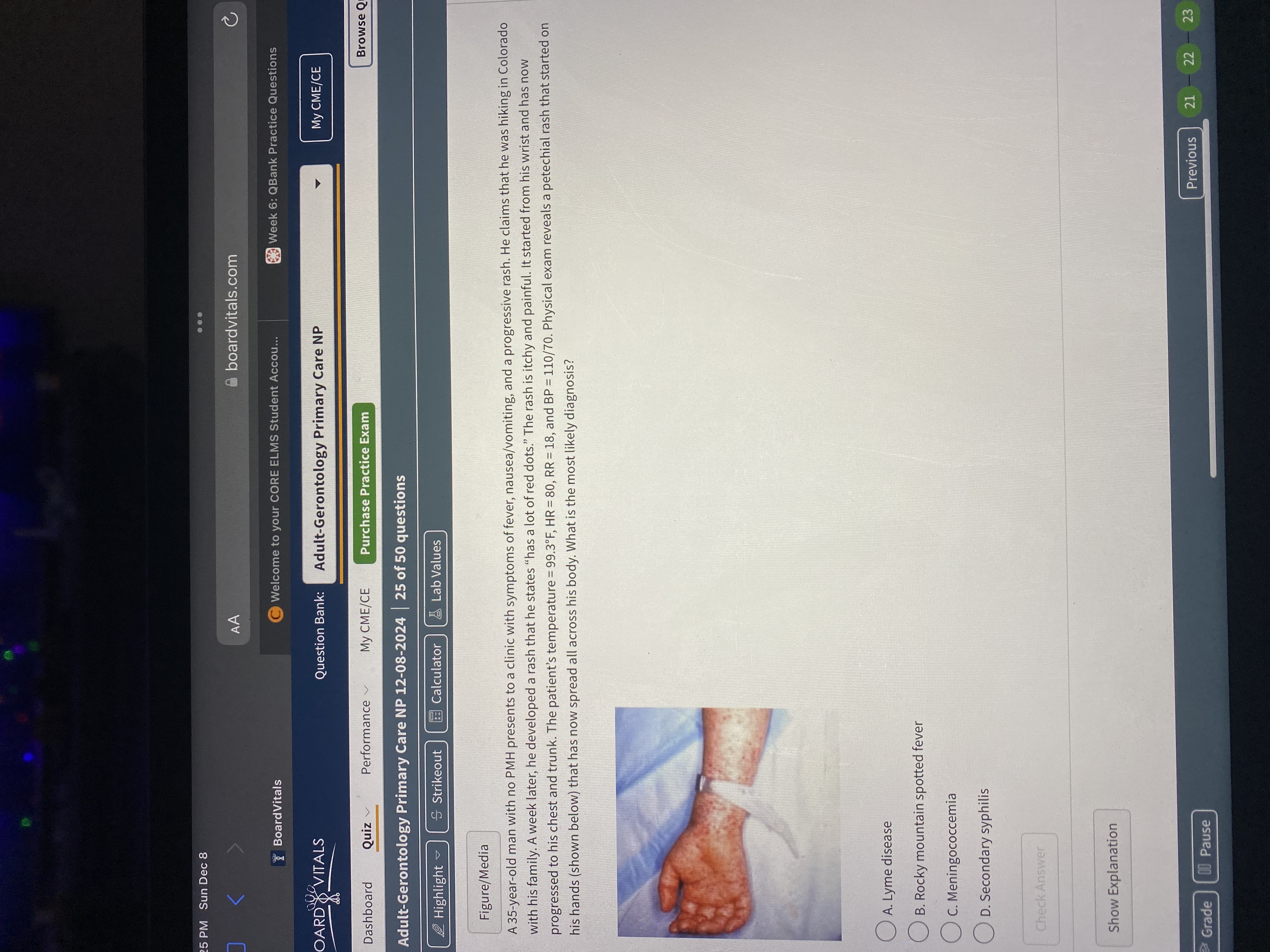 Answer 5 PM Sun Dec 8 .. . K AA boardvitals.com C