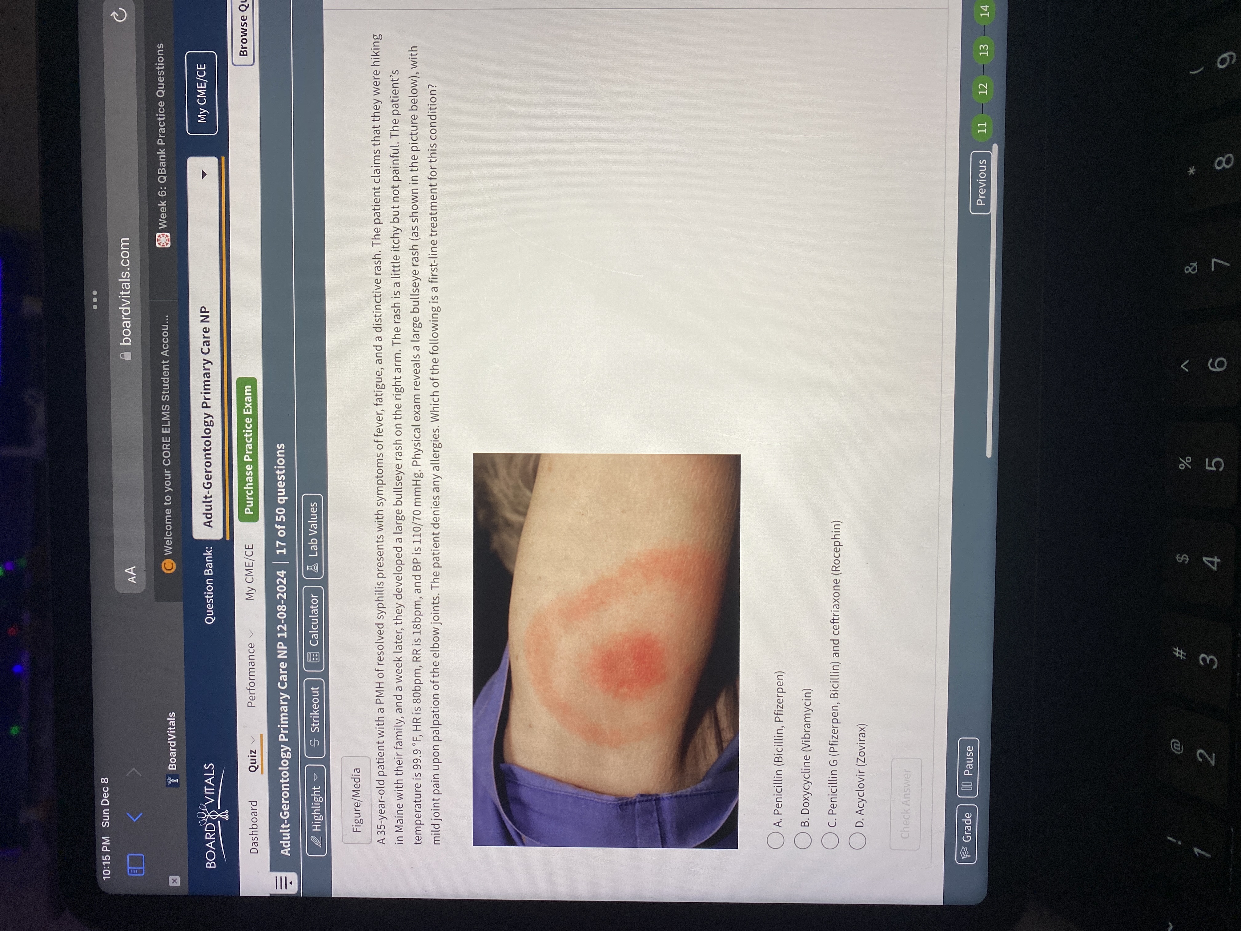 Answer . . . 10:15 PM Sun Dec 8 C AA