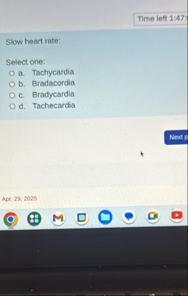 Time left 1 : 4 7 : Slow heart rate: Select one: