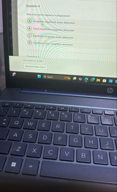 Question 4 What is the correct sequence in