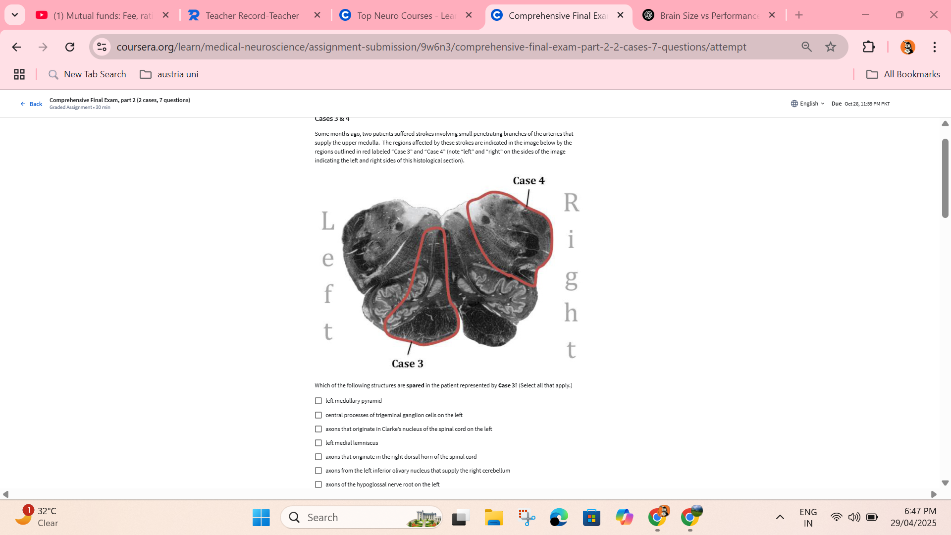 answer this (1) Mutual funds: Fee, rati X | ~