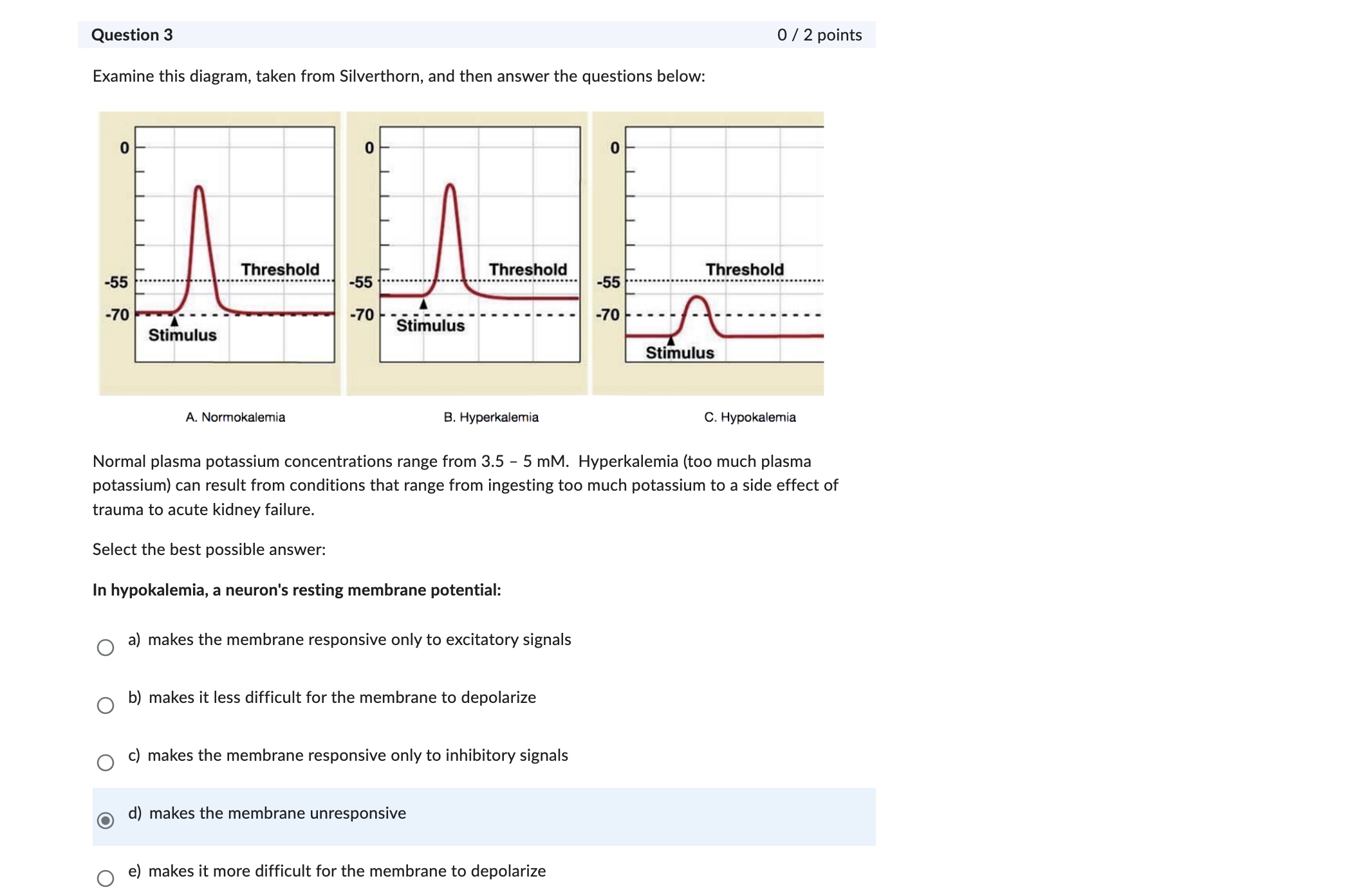 Question 6 0/2 points Clinical correlation: A