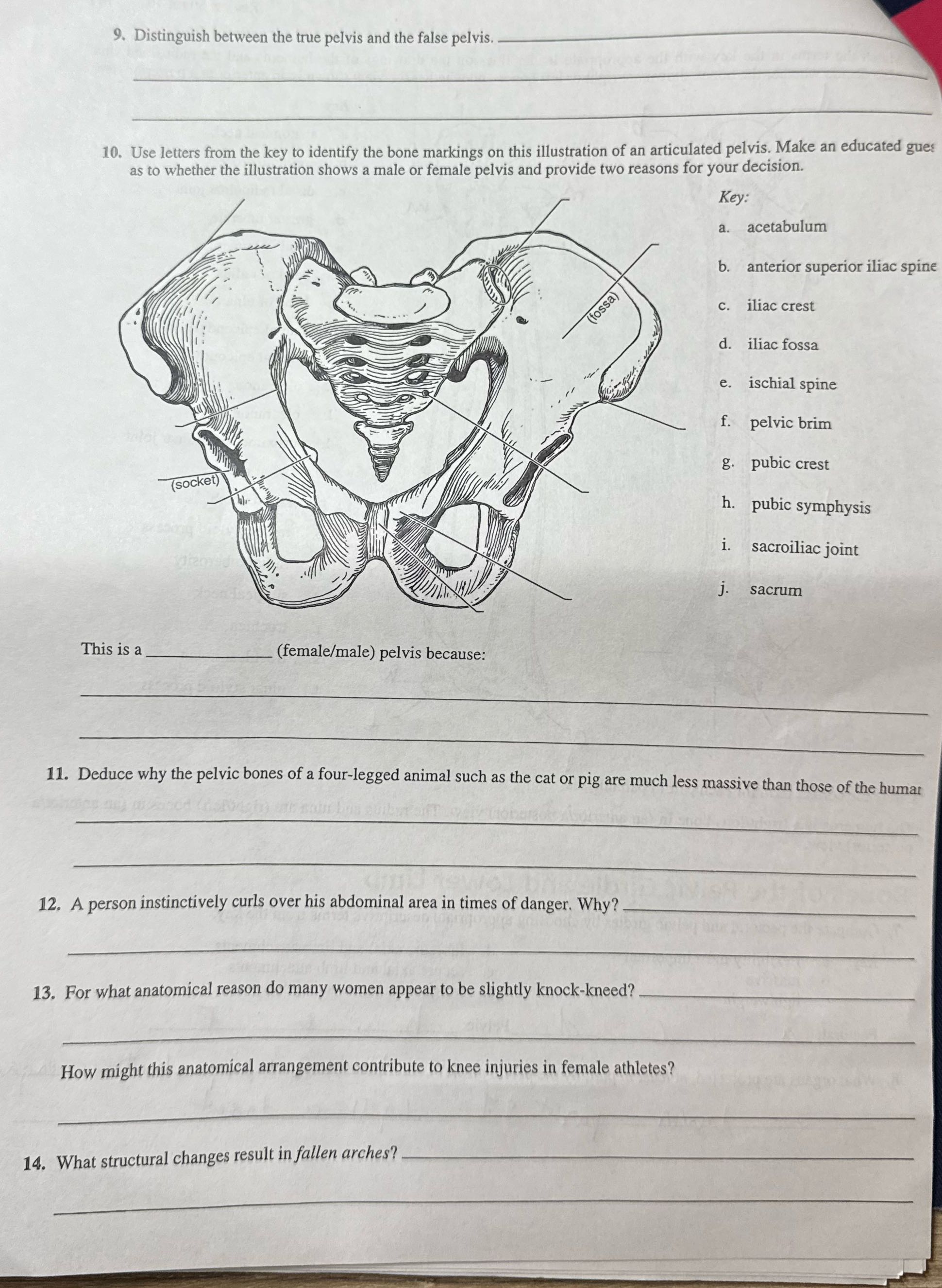 help 9. Distinguish between the true pelvis and