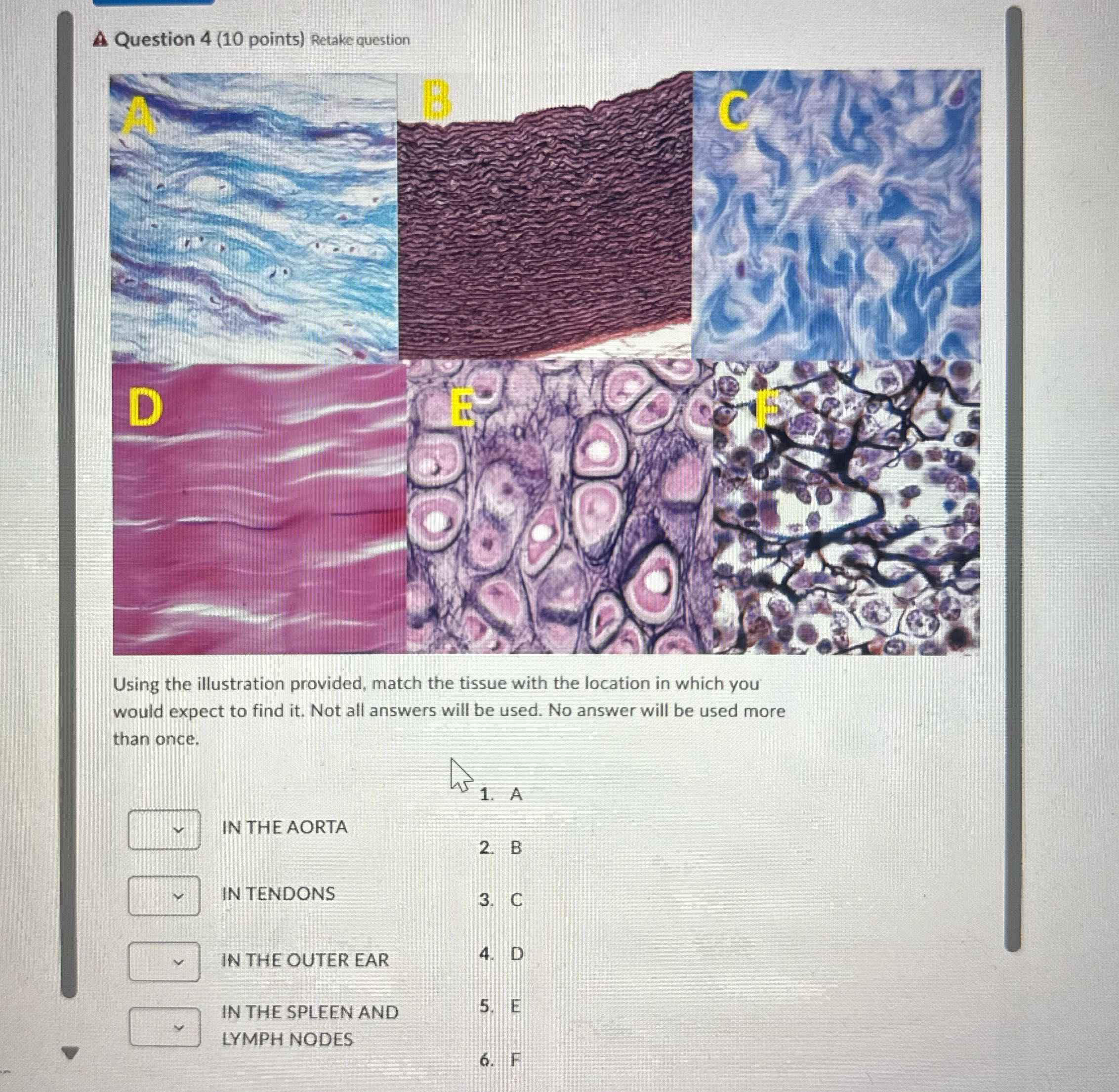 A Question 4 (10 points) Retake question B D