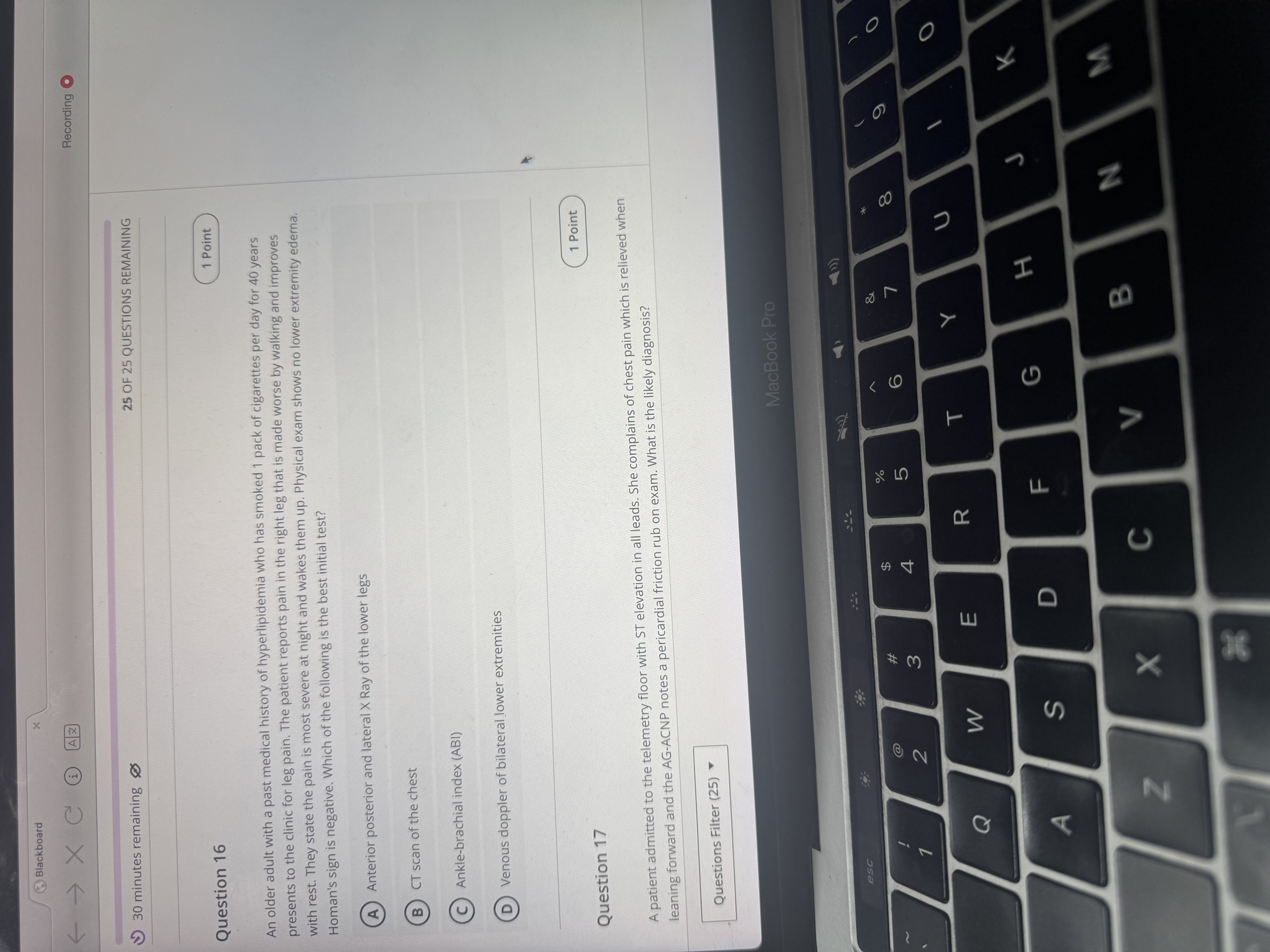 Answer Blackboard < - X C H A Z Recording 30