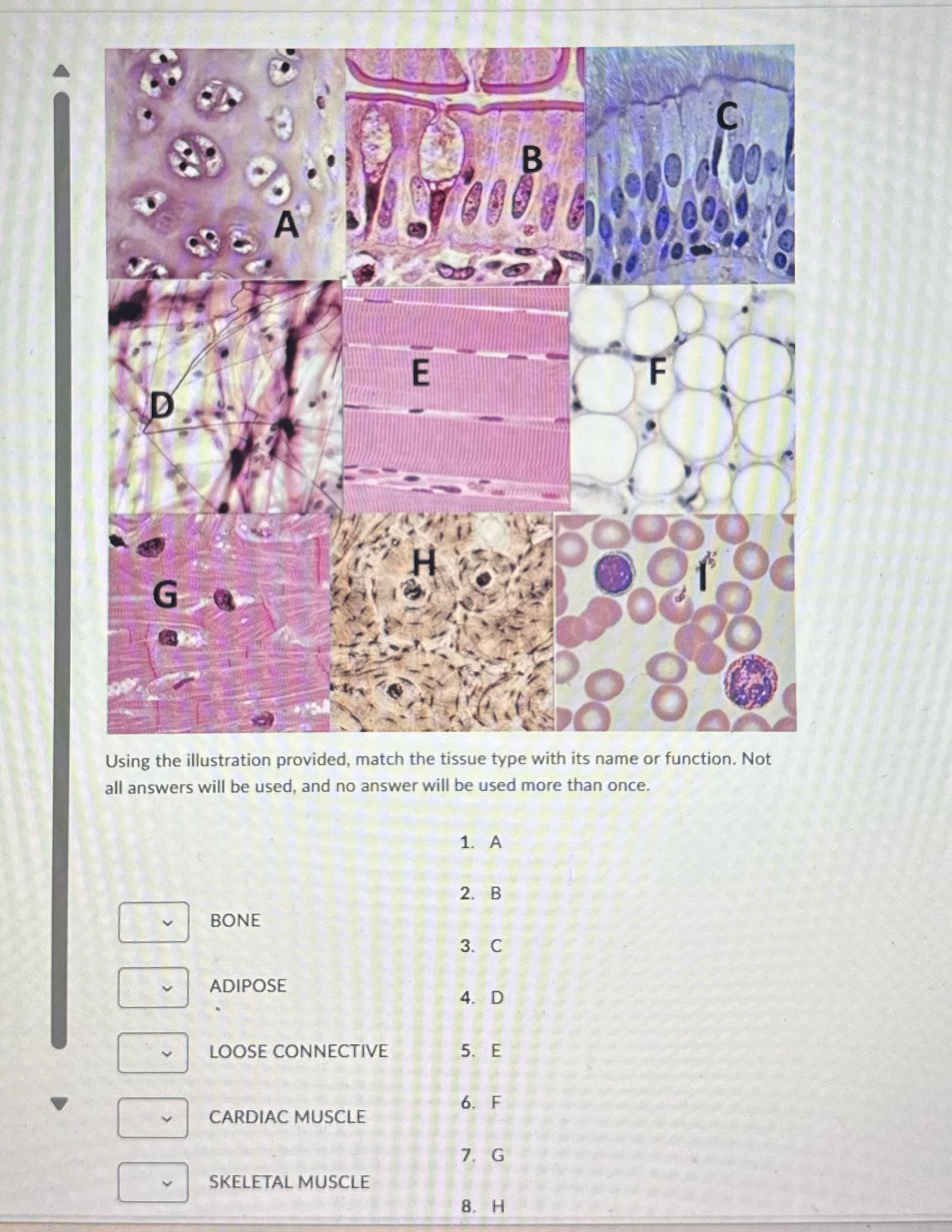 Using the illustration provided, match the tissue
