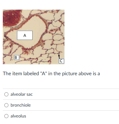 solve for A A B C The item labeled "A" in the