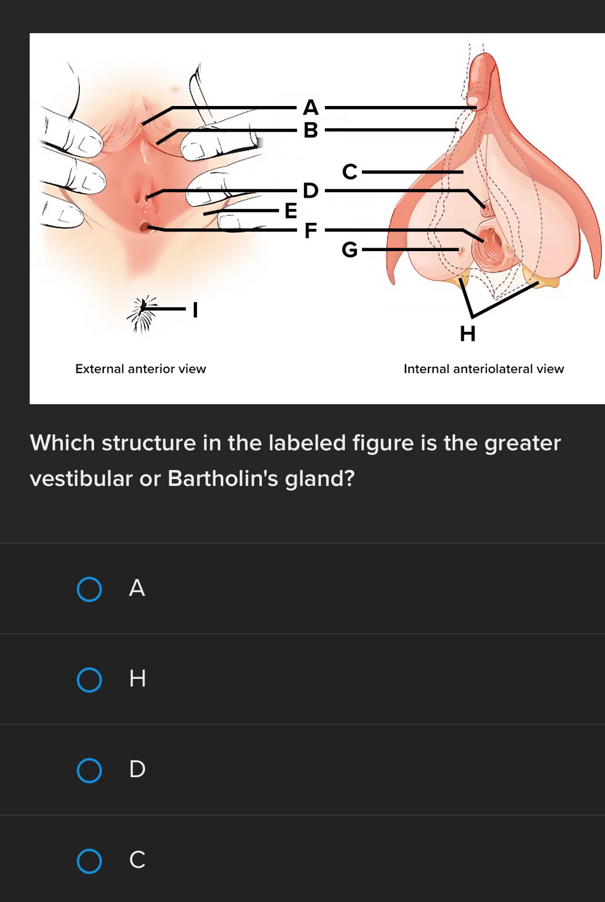 A B D E F H External anterior view Internal