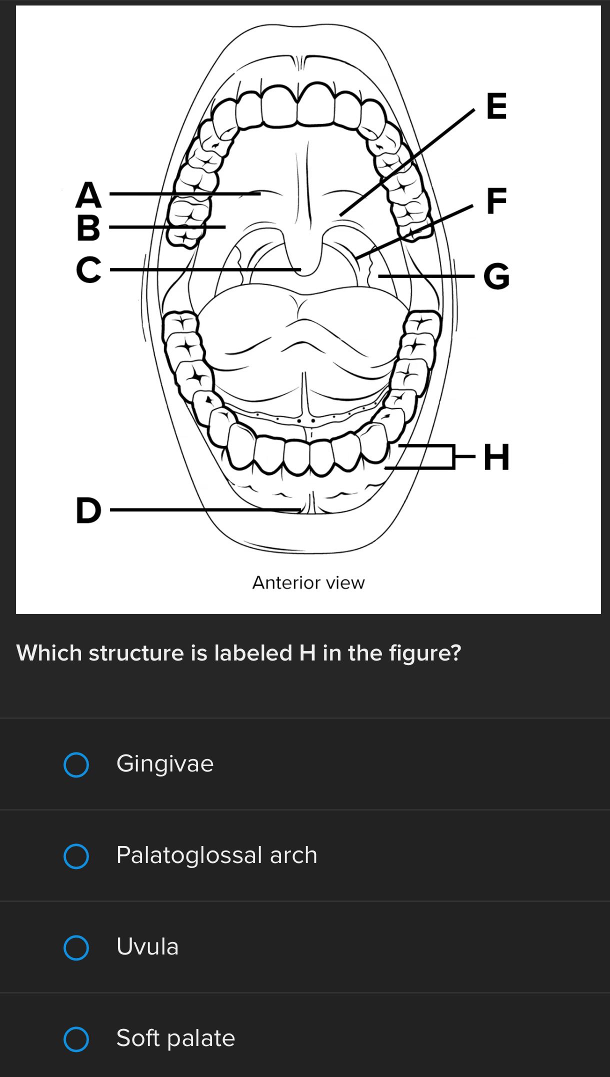 E H D Anterior view Which structure is labeled H