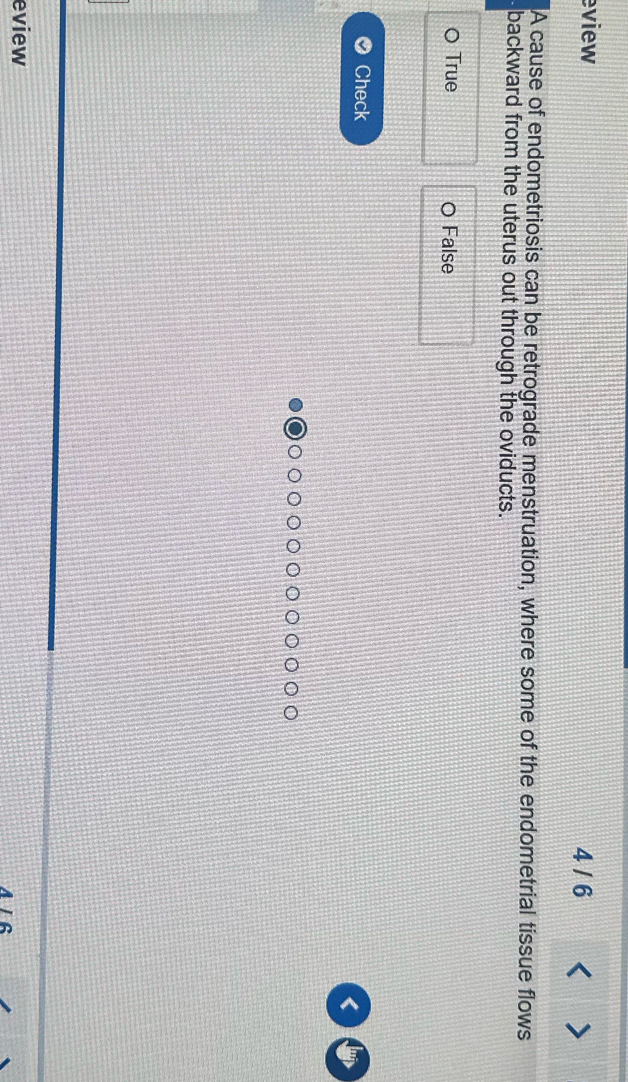 eview 4/6 A cause of endometriosis can be