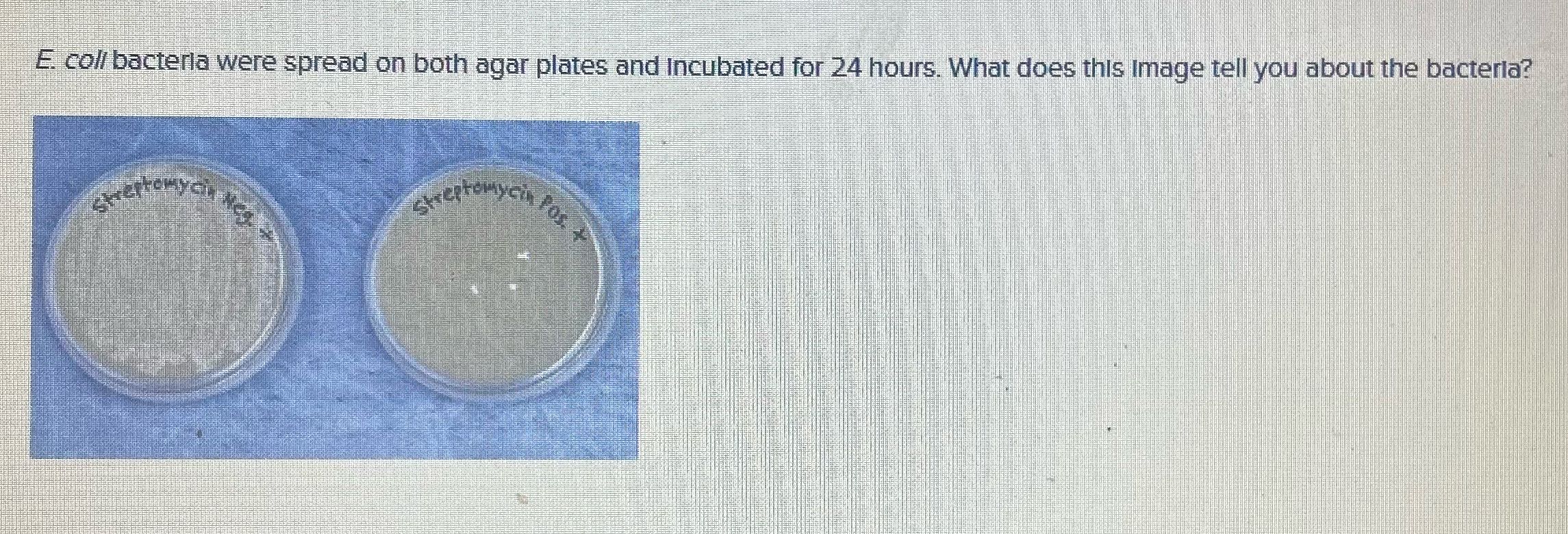 E. col/ bacteria were spread on both agar plates