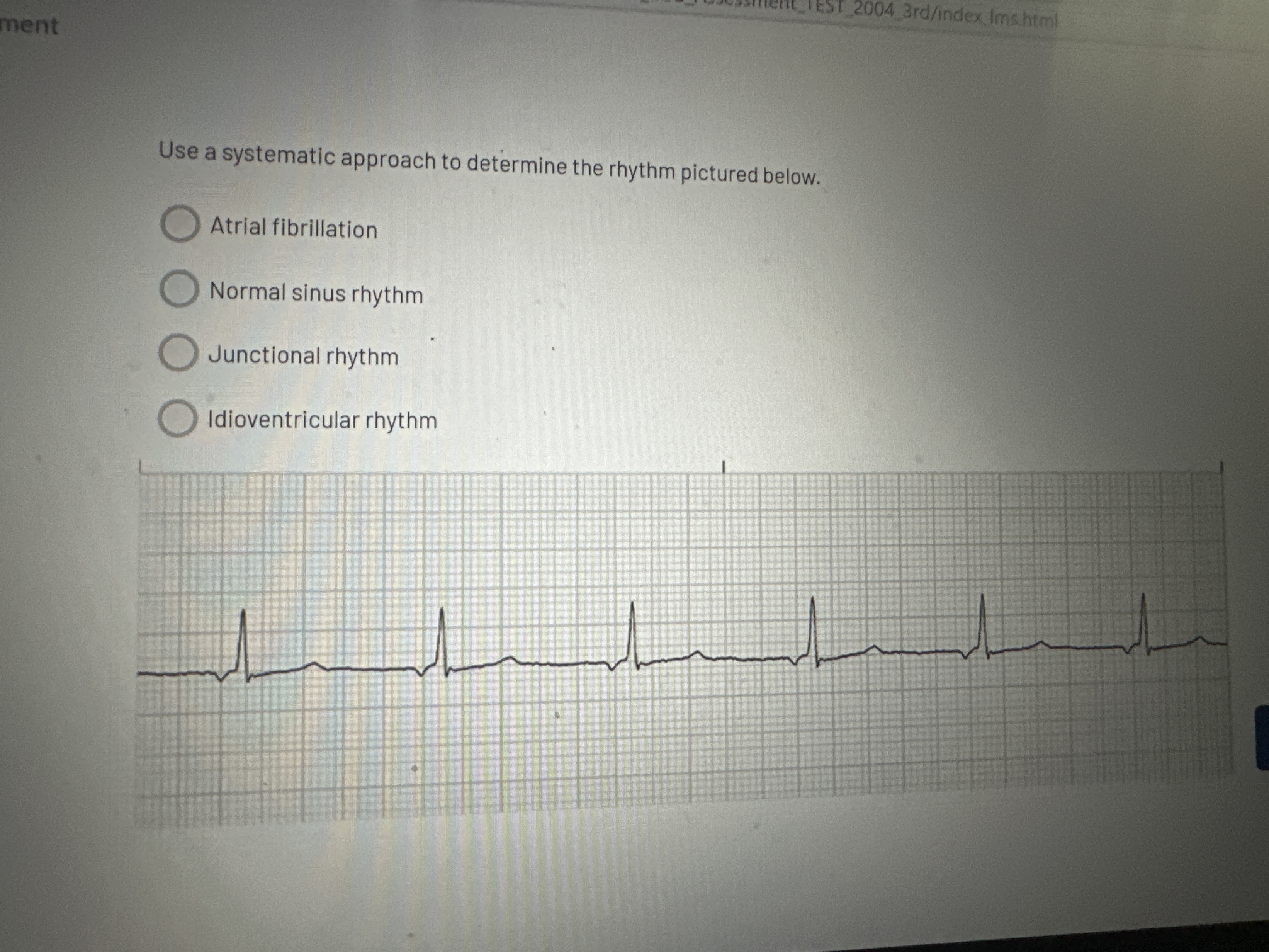 Answer question TEST 2004 3rd/index Ims.html ment