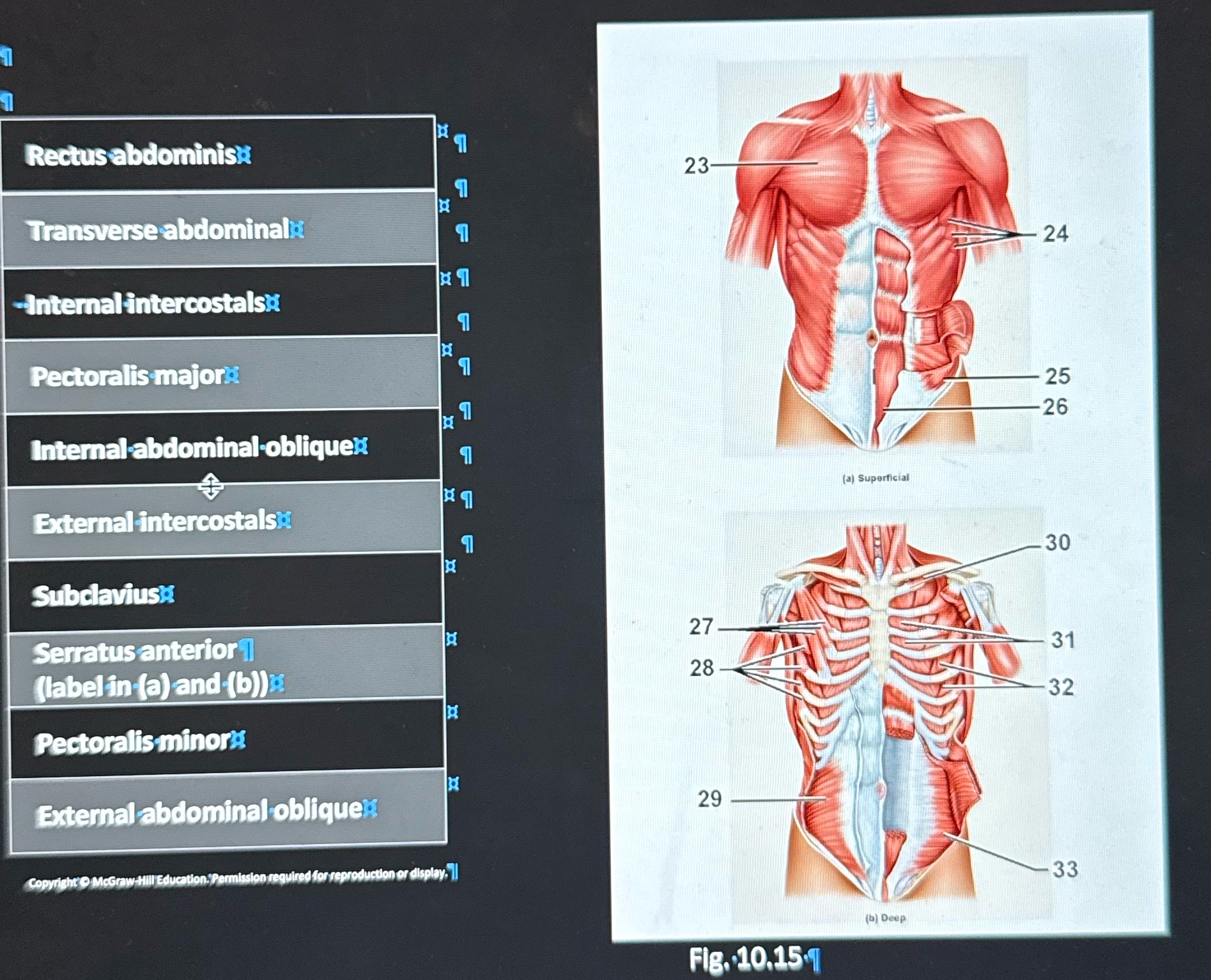 Label Rectus abdominish 23 Transverse abdominala