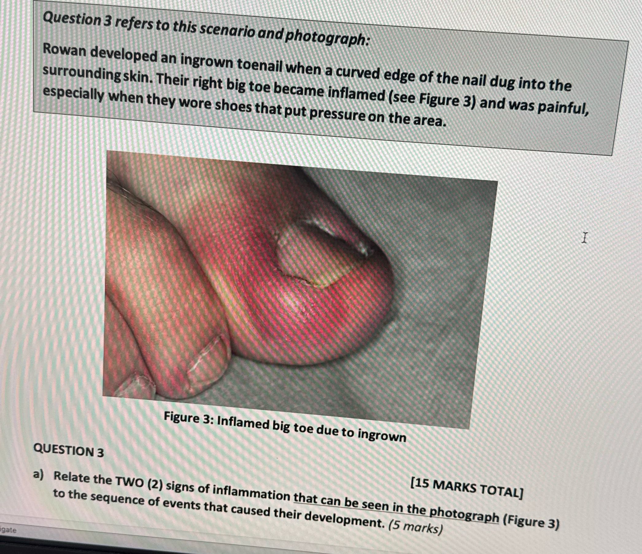 Question 3 refers to this scenario and