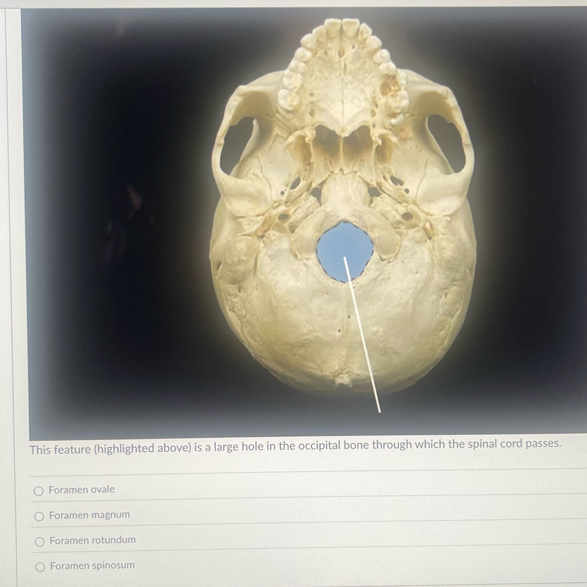 What is the correct answer This feature