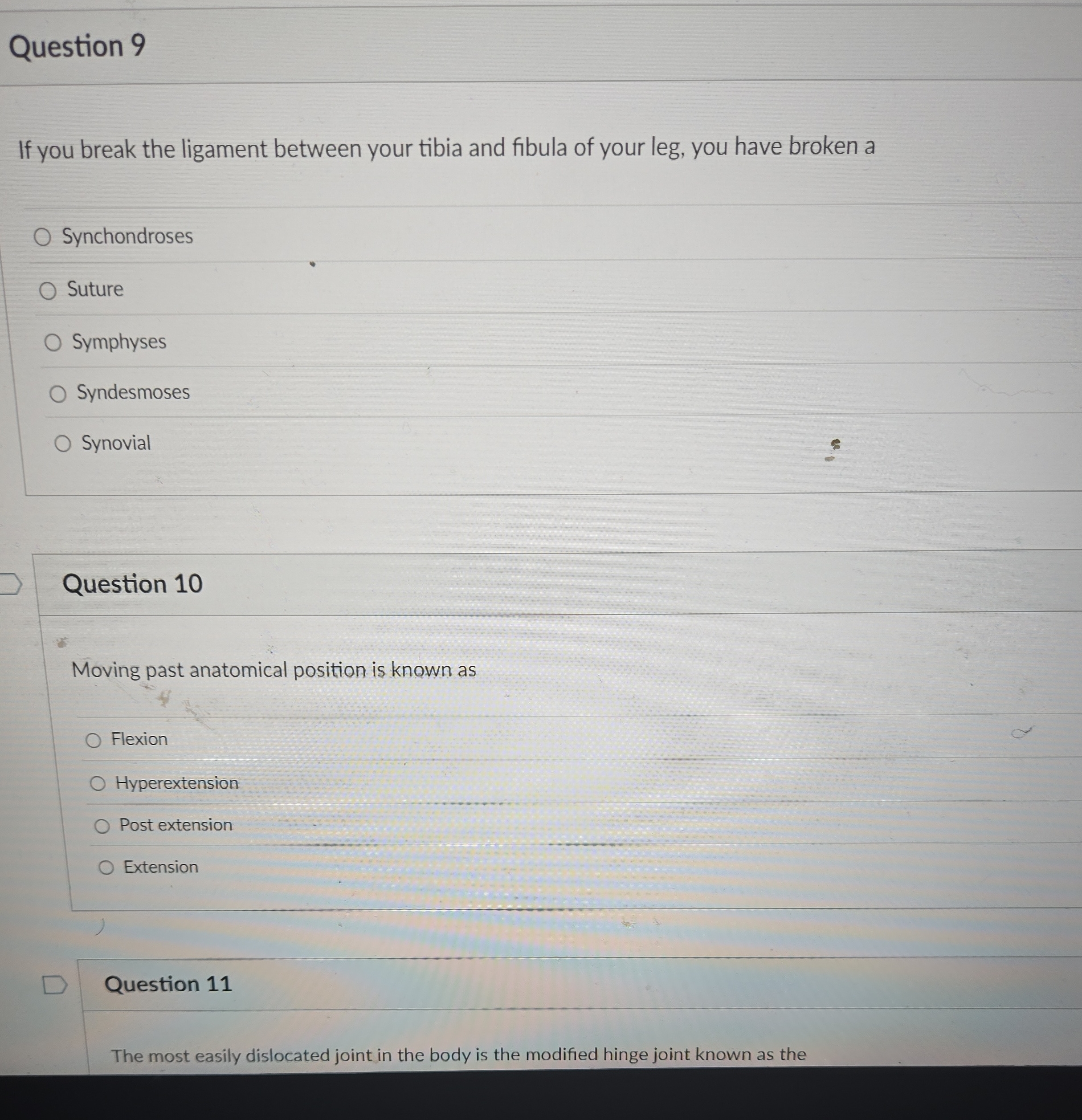 Question 9 If you break the ligament between your