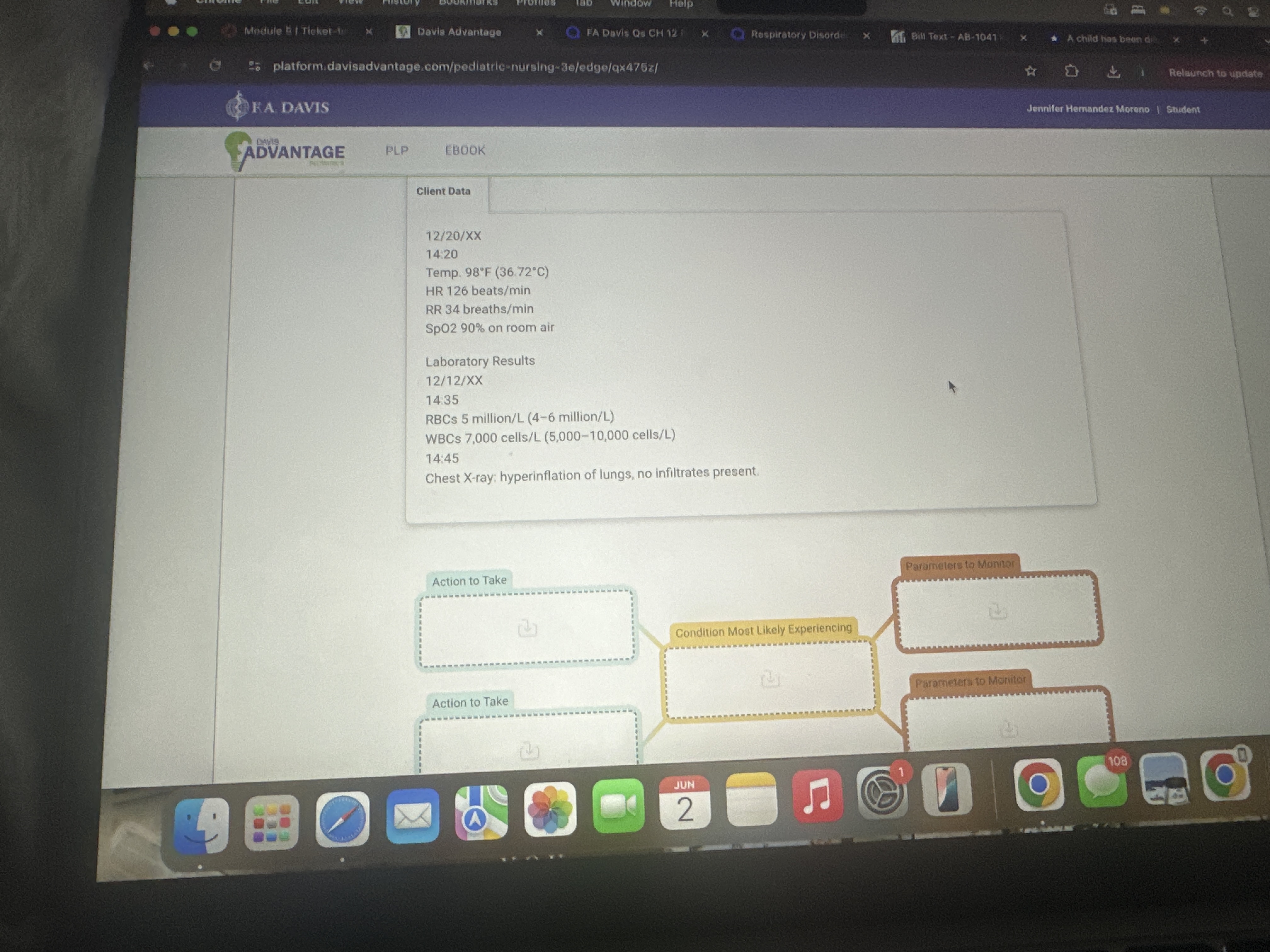 Module : | Ticket-to Davis Advantage FA Davis Qs