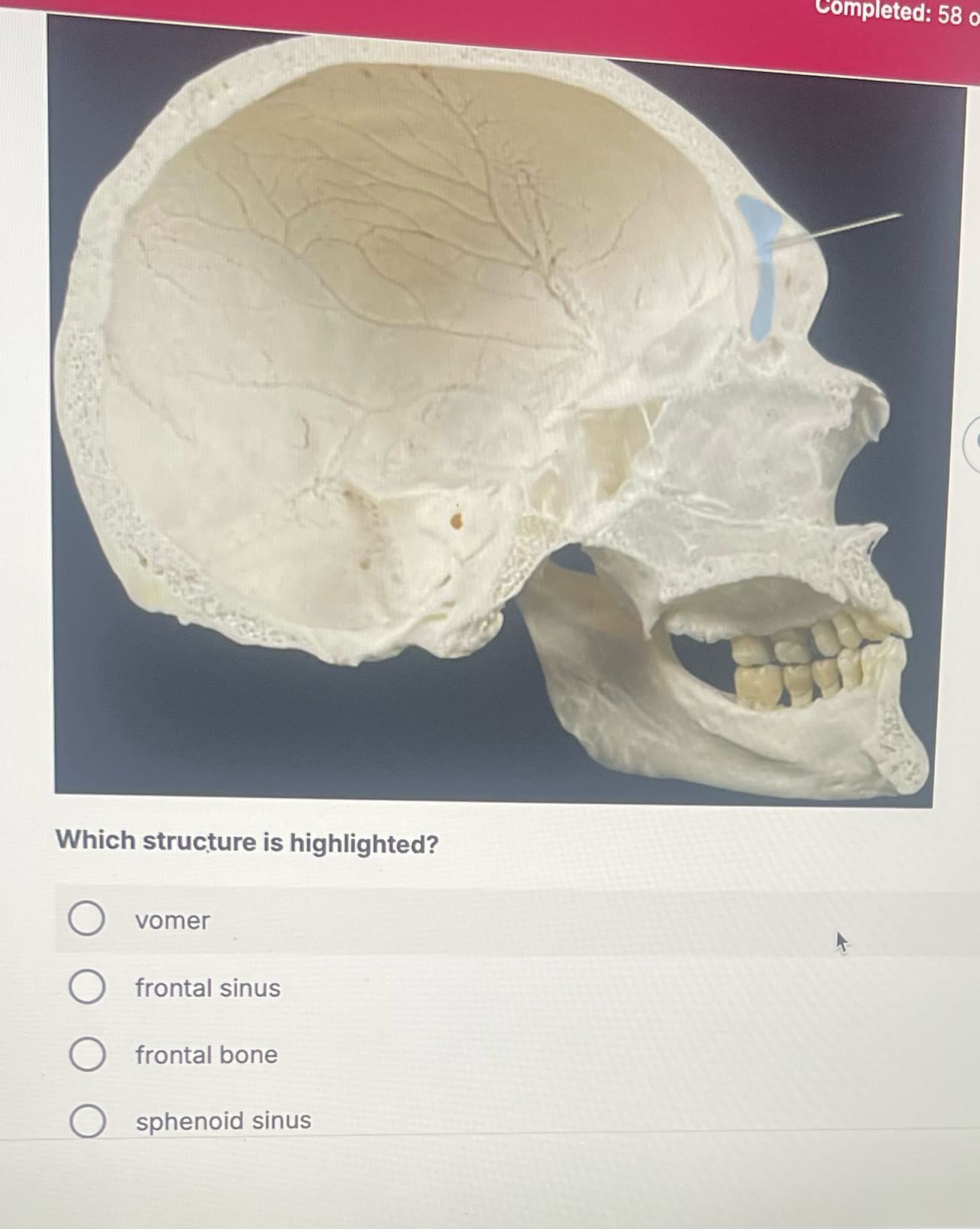 Completed: 58 o Which structure is highlighted? O