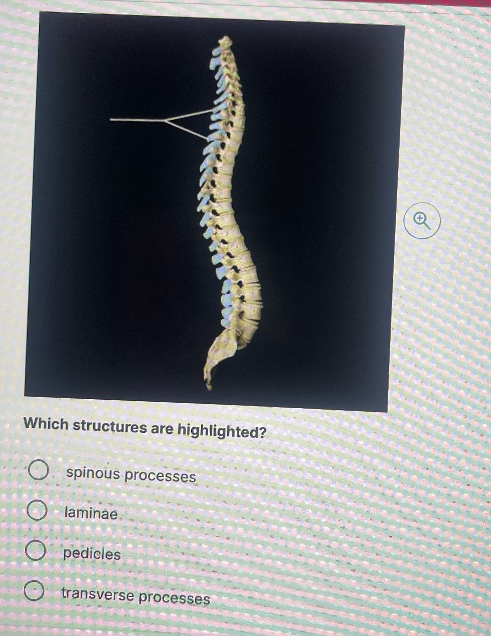 + Which structures are highlighted? spinous