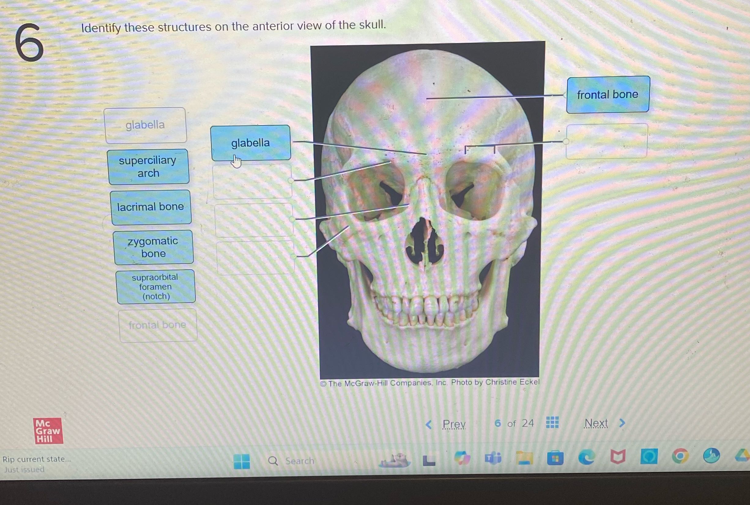 6 Identify these structures on the anterior view