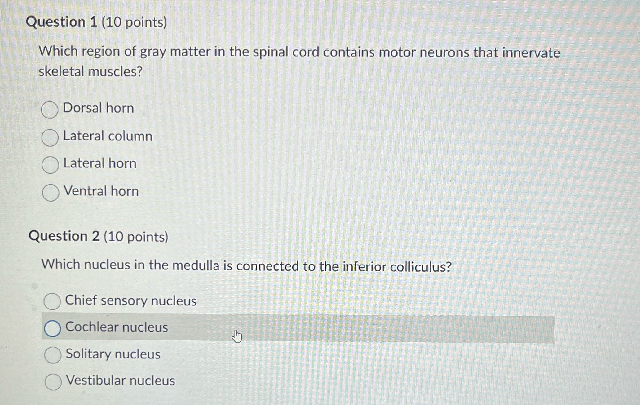 Question 1 (10 points) Which region of gray