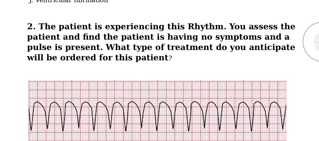 2. The patient is experiencing this Rhythm. You