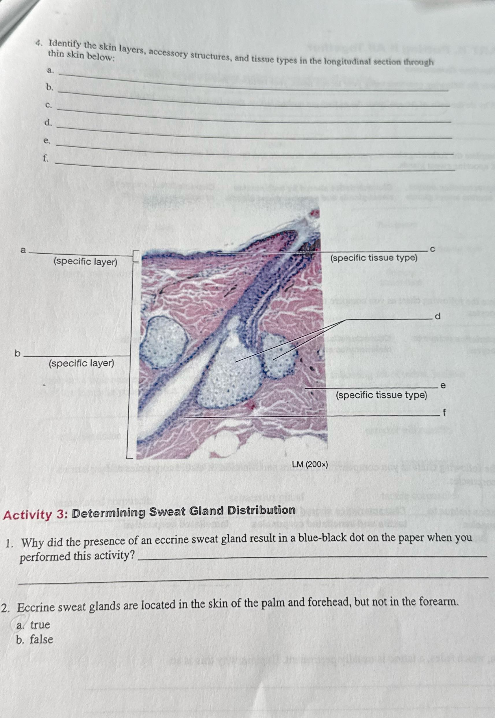 help thin skin below: 4. Identify the skin