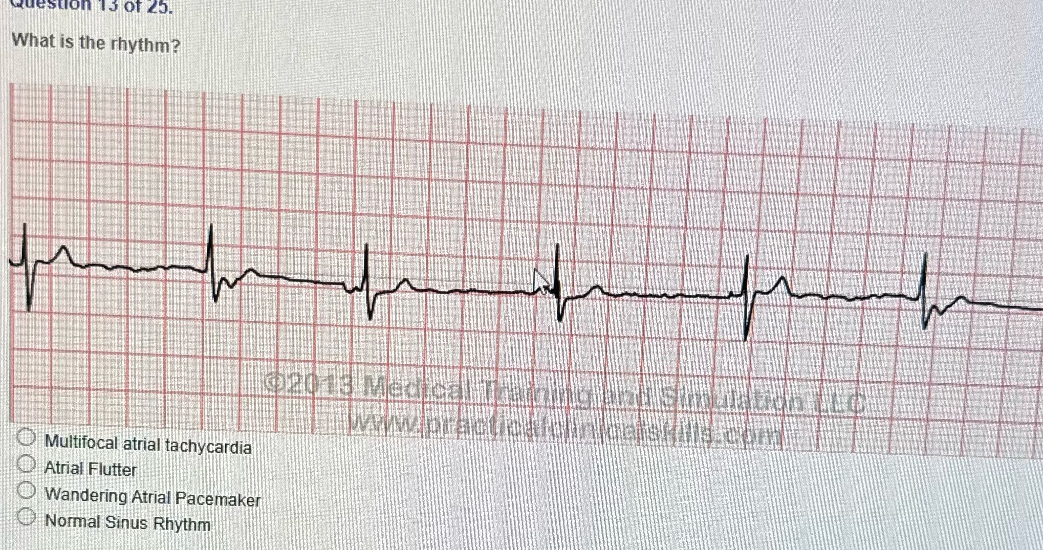 Correct answer Question 15 Of 25. What is the