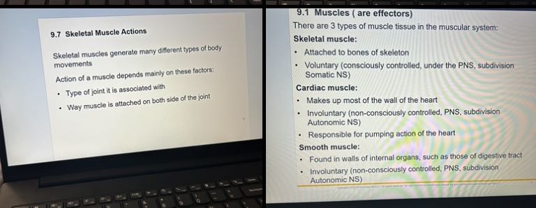 Using this image, summarize skeletal muscle structure. 9.1 Muscles ( are effectors)