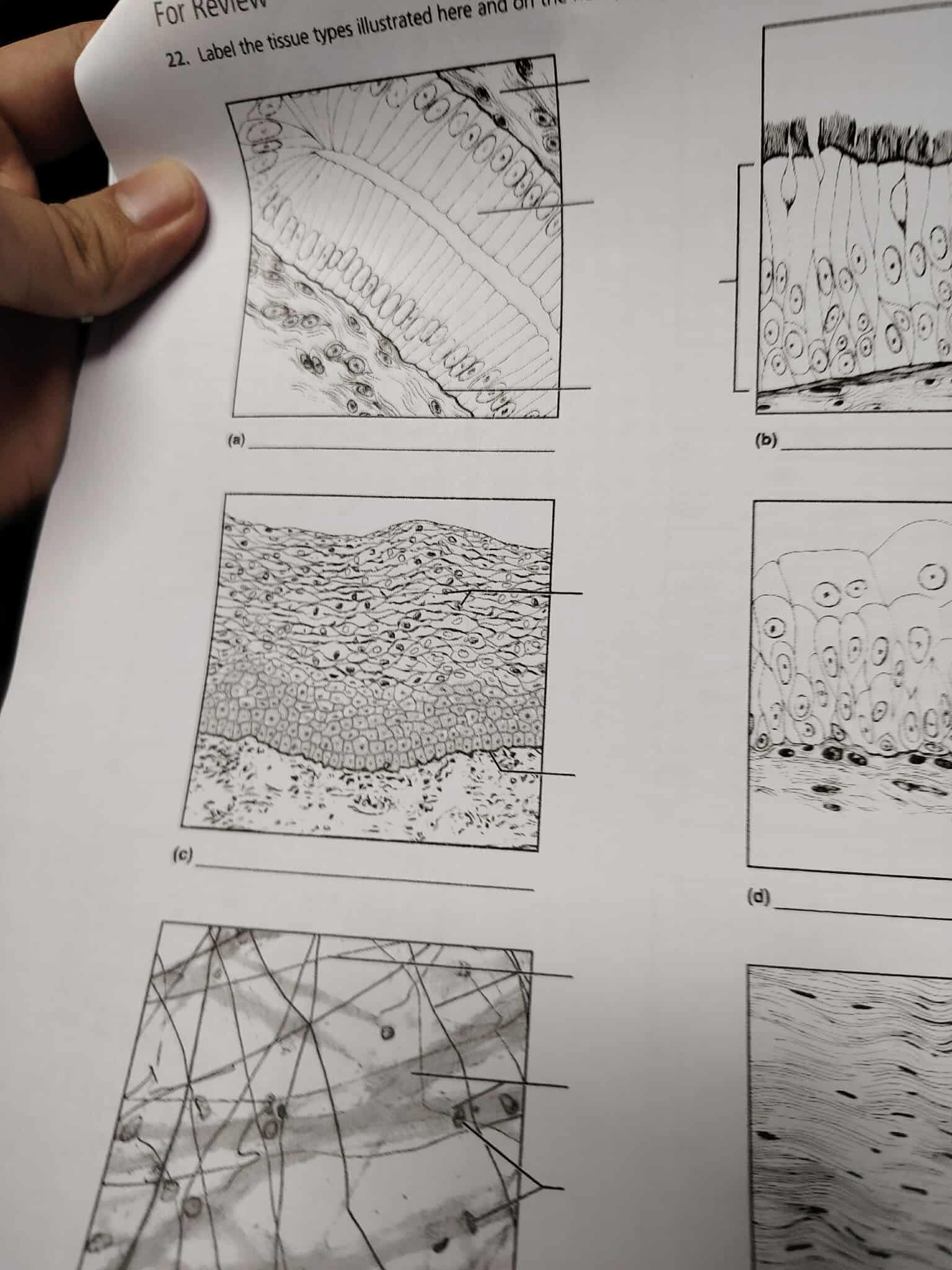 For Review whal the tissue types illustrated here