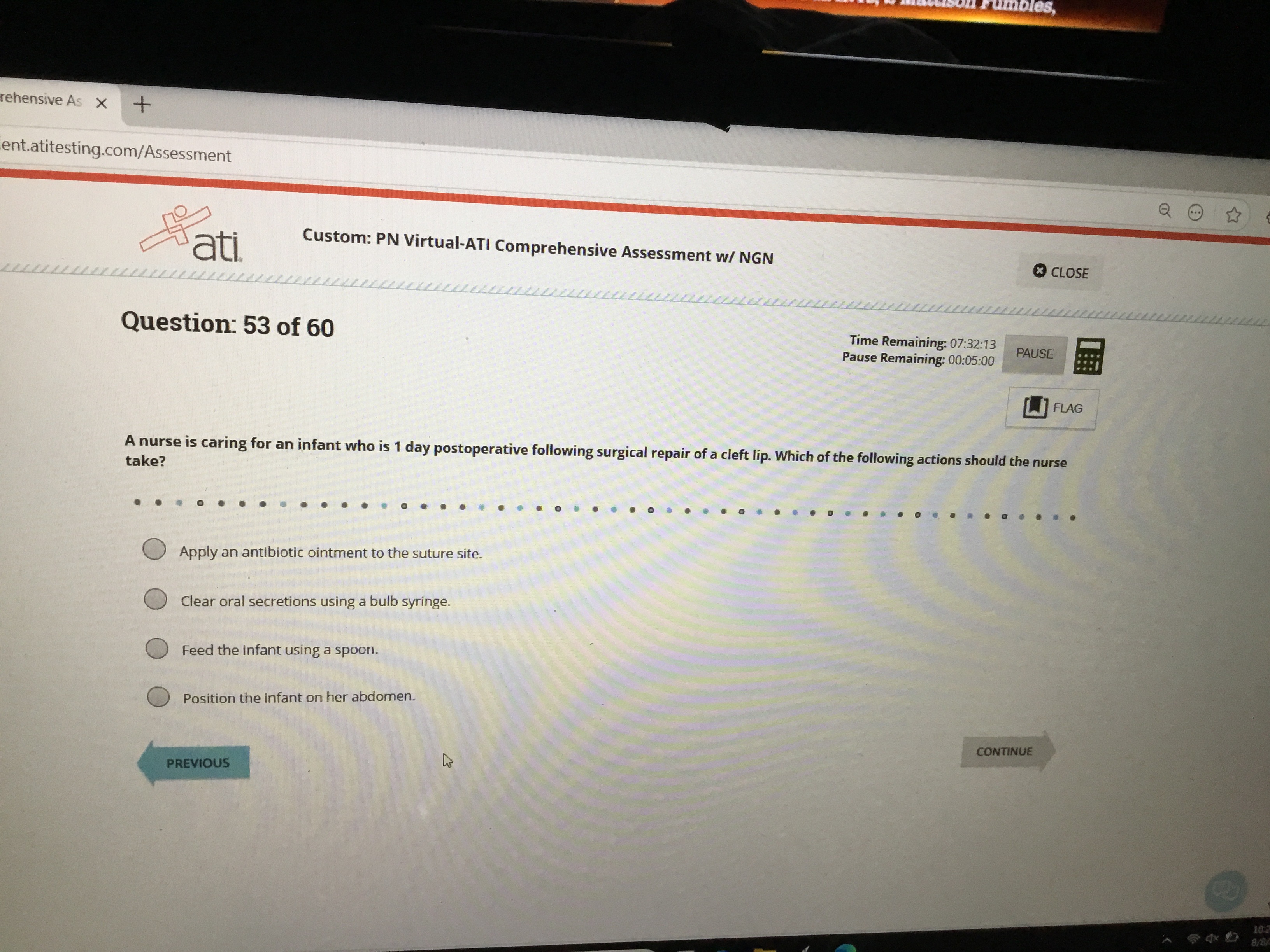 Answer this imbles, ehensive As X +