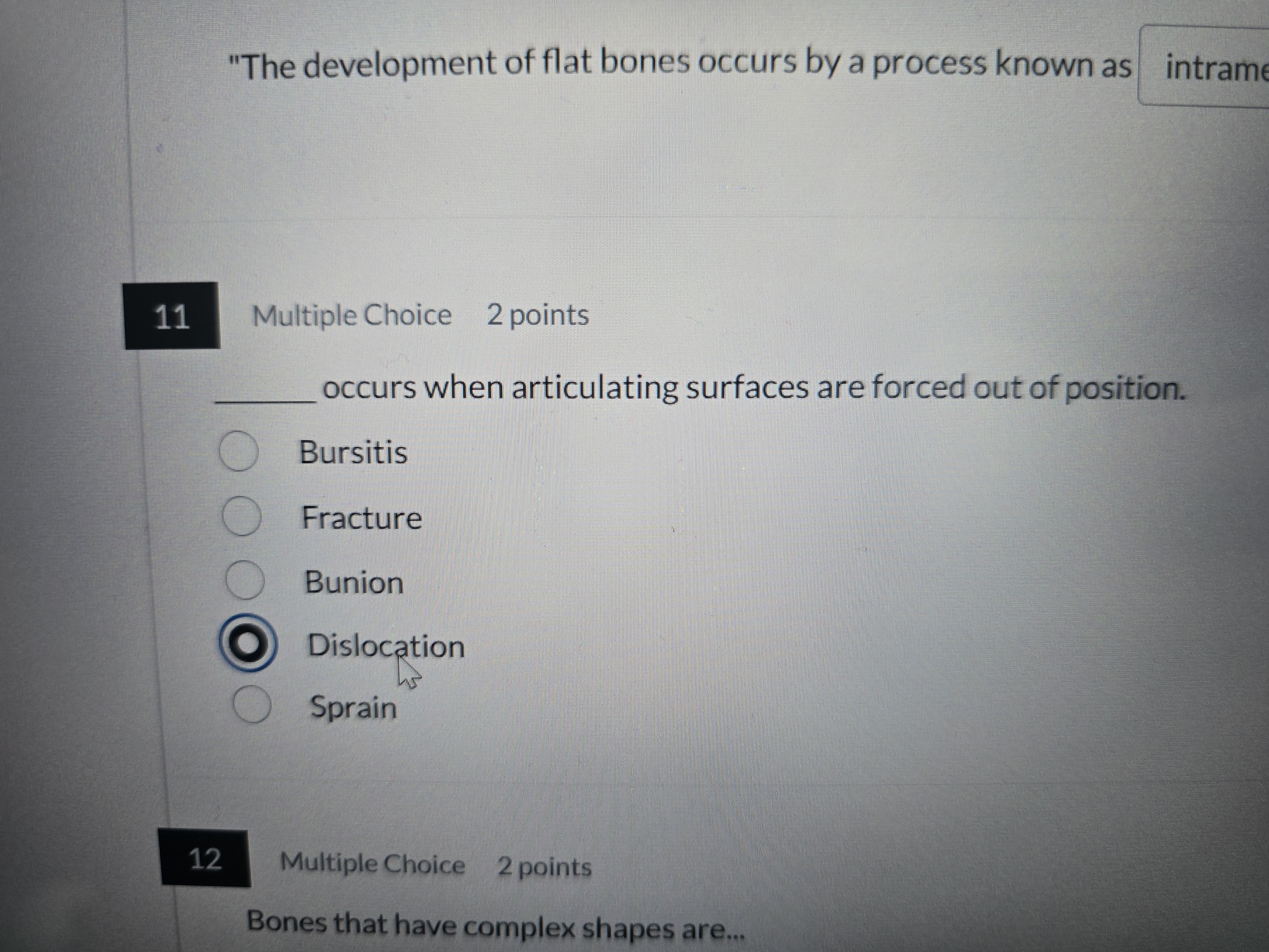 Solve please 'The development of flat bones