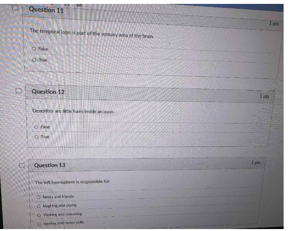 a Question 11 1 pts The temporal lobe is part of