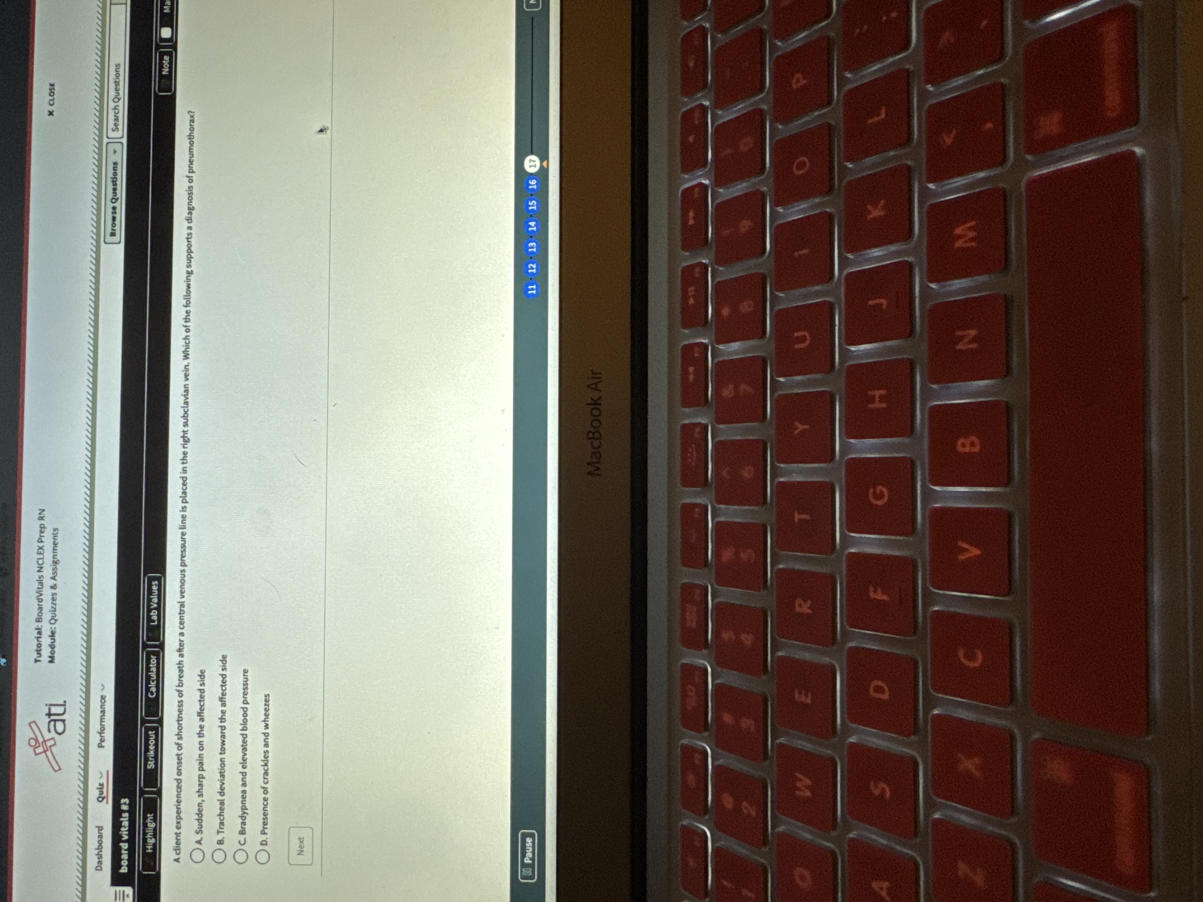 Pati Tutorial: BoardVitals NCLEX Prep RN Module: