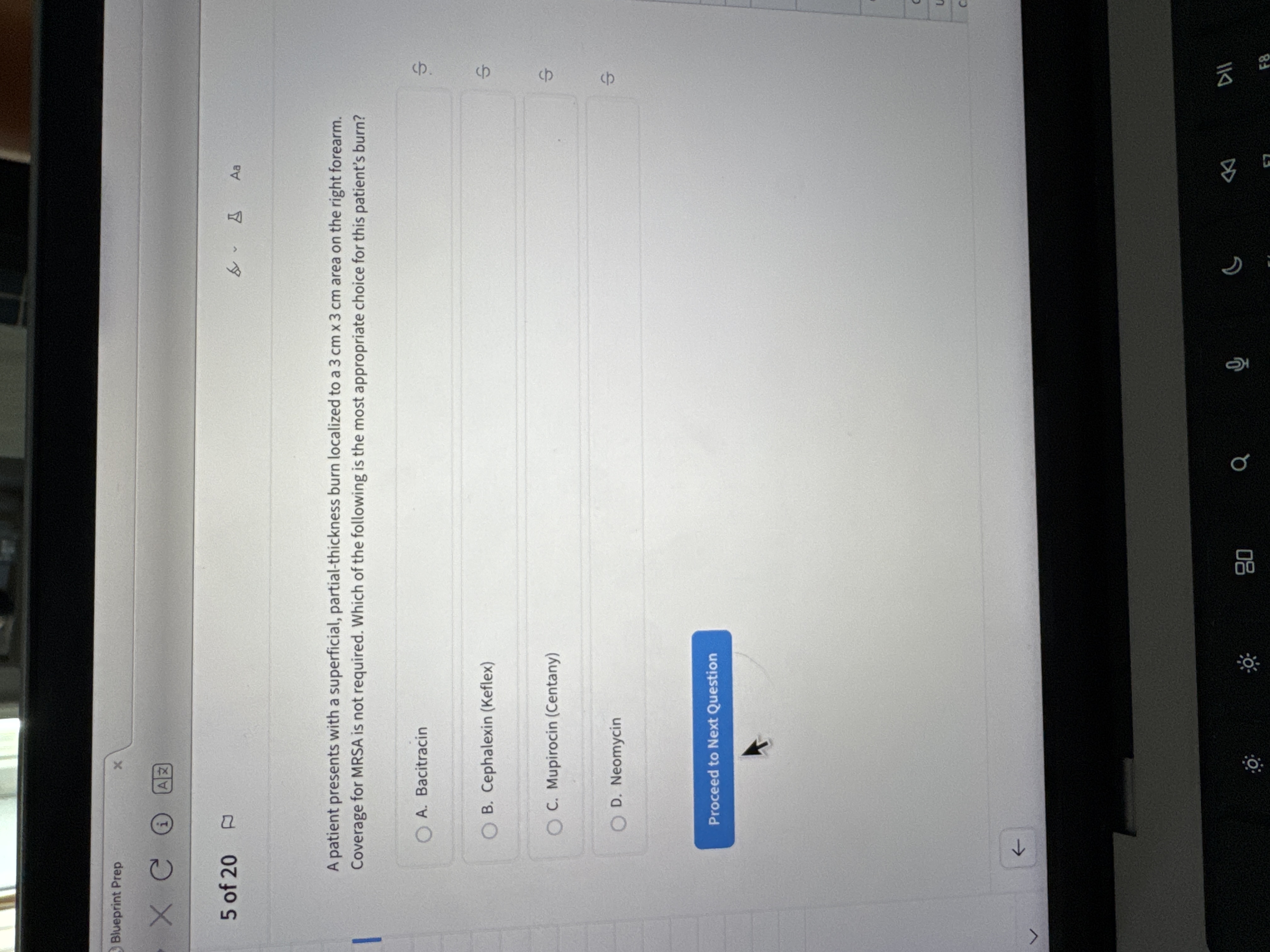 What is the correct answer? Blueprint Prep X CHAZ