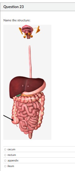 name the structure Question 23 Name the
