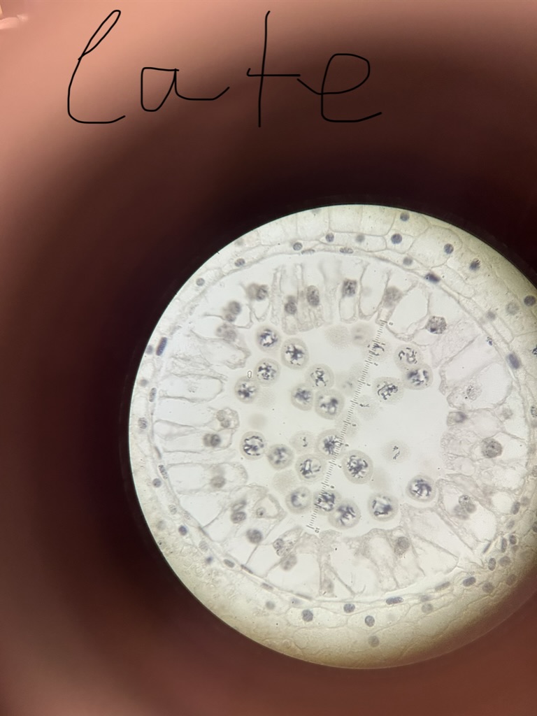 Observing the Stages of Meiosis See pictures for