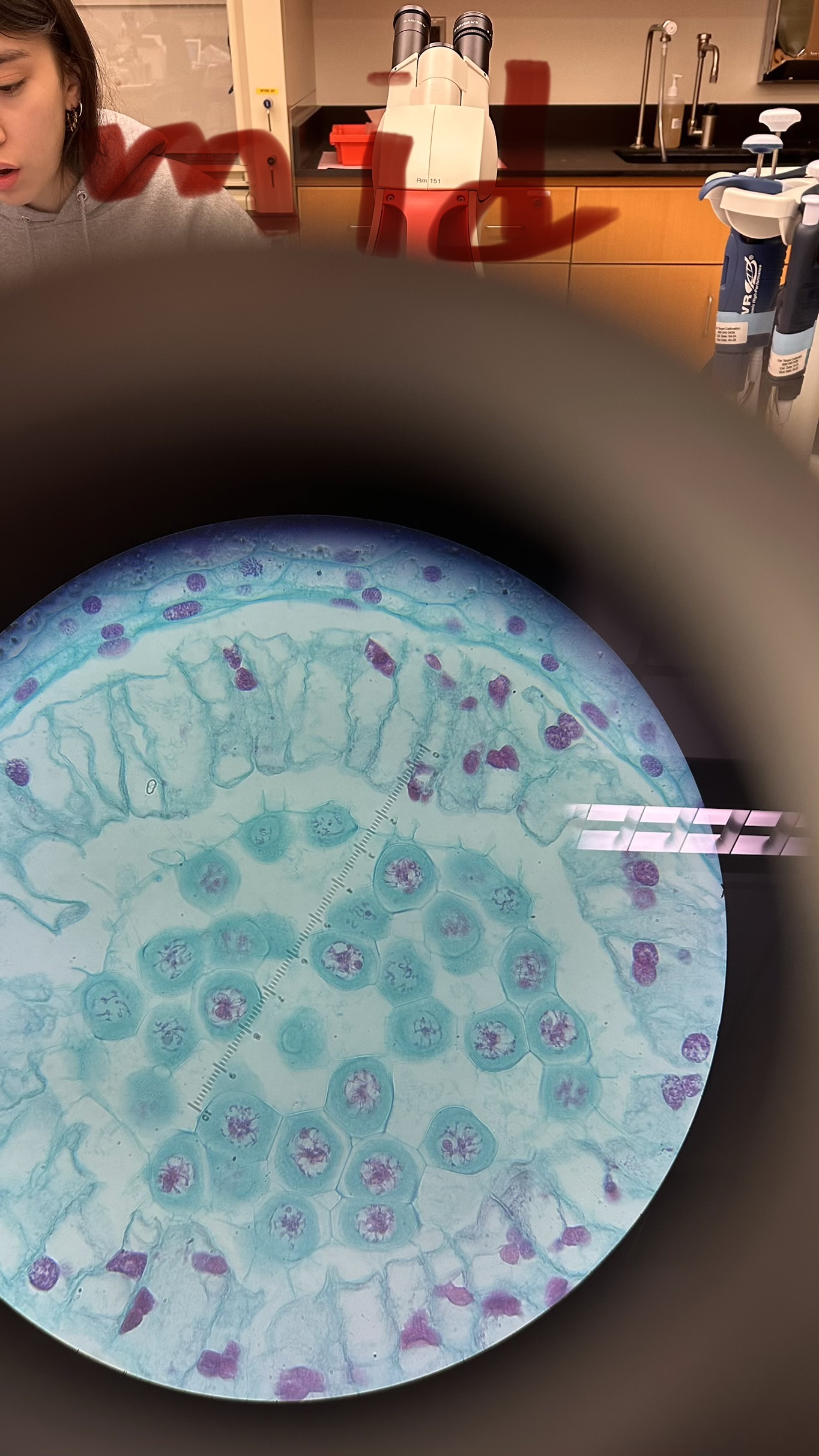 Observing the Stages of Meiosis See pictures for
